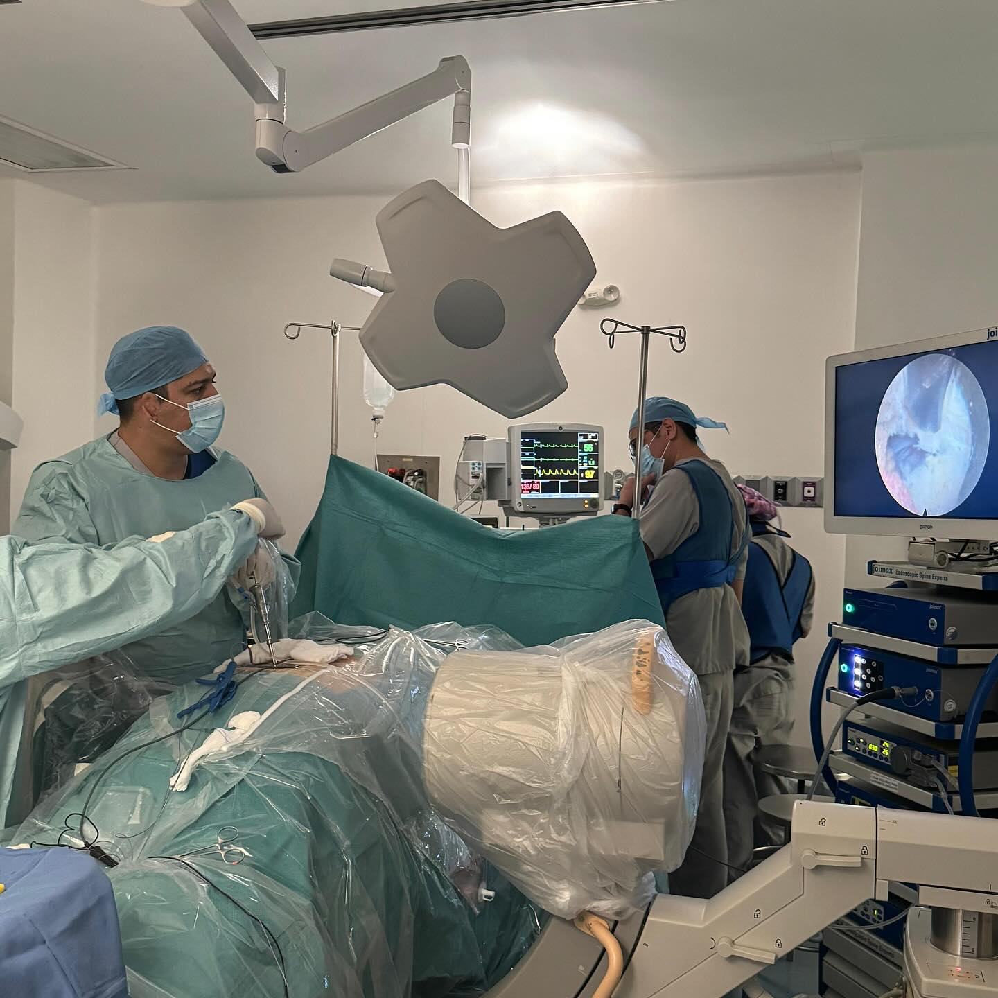 Cirugía endoscopica interlaminar lumbar