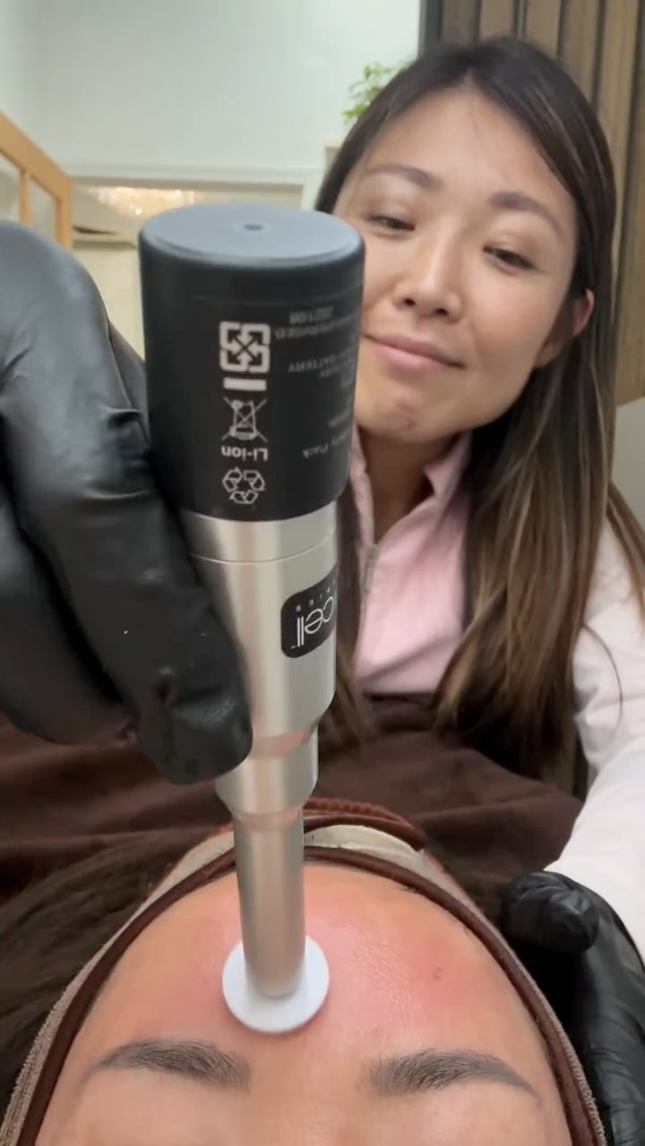 🌟 6-Month Skin Transformation Challenge — Microchanneling Edition 🌟
Ready to take your skin to the next level? Join our exclusive transformation challenge with 3 Microchanneling sessions for the price of 2! 💉✨
This treatment is a game-changer for:
🔸 Acne scars & texture
🔸 Fine lines & wrinkles
🔸 Large pores
🔸 Dull, tired skin
🔸 Hyperpigmentation
Microchanneling stimulates your skin’s natural repair process — boosting collagen, smoothing the surface, and revealing your glow from within 🌿
💫 3 sessions, spaced over 6 months
🙌 Limited to 5 people
📍 Lashes Brows Skin Clinic, Pasadena
Are you in? Let’s glow together ✨
DM us “CHALLENGE” to join 💌
#MicrochannelingChallenge #SkinTransformation #PasadenaFacials #CollagenBoost #LashesBrowsSkin #NaturalGlowUp #HolisticSkinCar @procelltherapies @circadia #microchanneling #microneedling #ledfacial #antiaging #kbrauty #mensfacial #bigporessolution #deepcleanfacial