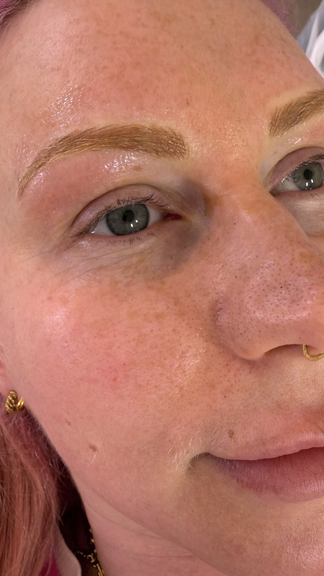 Brows
We love these results.
L I P B L U S H & E Y E L I N E R & B R O W S &
M E D I C A L T A T T O O all available!
DM us to find out more. In my treatments the aim is to Enhance beauty & looks in a very natural way to compliment and make you feel as good as possible with some added confidence. 👌🏻
Remember it’s not an expense it’s self care!
👩💻 𝐰𝐰𝐰.𝐝𝐚𝐧𝐢𝐞𝐥𝐥𝐞𝐣𝐚𝐦𝐞𝐬𝐜𝐥𝐢𝐧𝐢𝐜.𝐜𝐨.𝐮𝐤 🇬🇧 𝐓𝐨 𝐁𝐨𝐨𝐤
✉️ DM us with your enquiries
#lipblush #lipblushing #lipliner #liptattoo #lipblushtraining #lips #lipcare #lipsliverpool #lipscare #pmulips #lipsonfleek #lipsoftheday #lipsonpoint #lipsofinstagram #biglips #lipstain #naturallipblush #semipermanentmakeup #permanentmakeup #nudeblushlips #lipblushtraining #lipblushingtattoo #lipblushartist #lipblushcourse #lipblushingtattoo #lipblushpigments