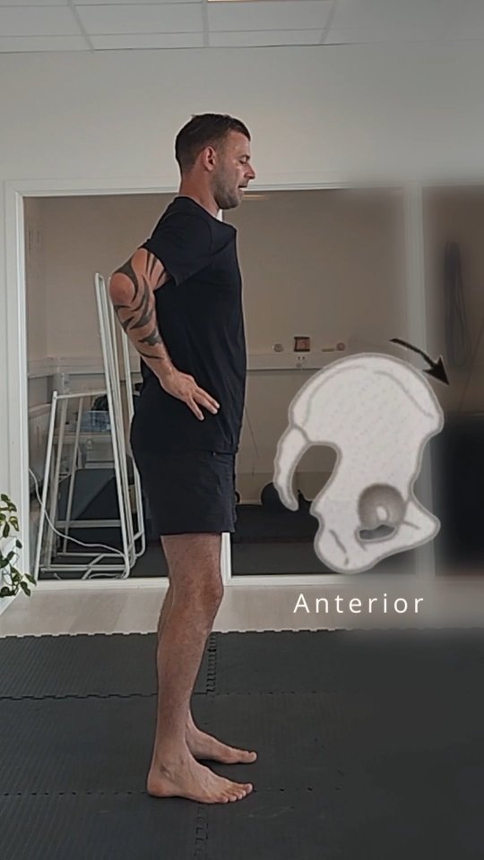 Har du mærker eller tænkt over før, hvorfor du skubber din hofte frem i rummet. Eller spænder ballerne for at holde stabiliteten ? 🤔
Vores krop kan udføre mange funktioner. Jo flere af de funktioner vi kan kontrollere, og gøre brug af i vores bevægelser. Jo større bliver vores bevægelsesfrihed 🎯
Så hvad kan vi bruge det til ?
At forstå hvordan vi kan bevæge os på en anden måde og skaber nye strategier, og stabilitet ✅
En af de kropsdele det ofte går udover er vores lænd.
Så tror man ofte at udfordringen ligger der.
Sådan er det dog for der meste ikke ! 🤌
Noget som jeg ser tit, er at forståelsen for hvor ens hofte/bækken er i rummet, så et "shift". 📐 Kapaciteten for at integrere et "anterior" - "posterior" til i vores bevægelser skaber en kæmpe forandring.
Hvorfor ?
Det har flere grunde, en af de store er at hofte, bækken området så overtager bevægelser, samt stabiliserer mere hensigtsmæssigt.
Så vores lænd, den "lumbale" del kan gøre det den enlig er skabt til at gøre.💯
Hoften, bækken, bækkenbund og vejrtrækning er meget interessante områder ved symptomer i lænden.
Har du brug for hjælp, eller gerne vil videre mere. Så send mig optagelser af dine øvelser.➡️
#biomekanik #funktioneltræning #holisticcoaching #breathing #rotation #performance #smertefri #balance #hofte #bækken #viralreels