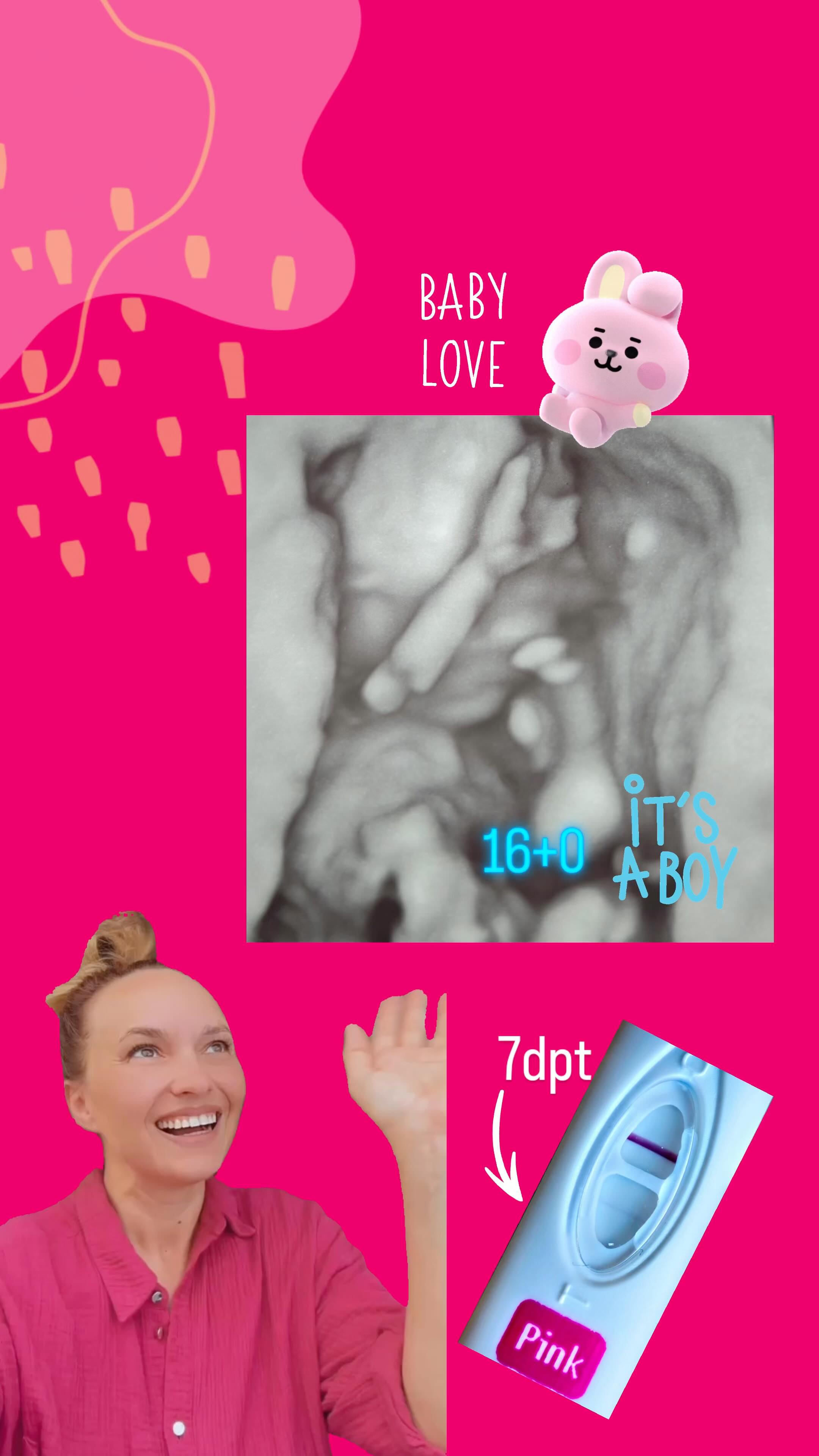 Z tym małym gentelmanem i jego cudowną mamą poznaliśmy się przy transferze 😍
To był już trzeci transfer – szczęśliwy 💛
Mama, choć z solidnym naukowym zapleczem, od początku czuła, że chce połączyć medycynę zachodnią z naturalnym wsparciem. Towarzyszyłam jej przy wszystkich trzech podejściach, wspierając ciało i emocje akupunkturą.
Dziś mam ogromną radość oglądać to 3D zdjęcie małego chłopca i wiedzieć, że już rośnie i ma się dobrze. ✨
Za każdym razem, gdy dostaję takie zdjęcia – czuję wzruszenie. Dziękuję, że mogę towarzyszyć Wam na tej drodze. ❤️
Zaopiekuj się sobą w Bertha Holistic 🌿
•••••••••••••••••••••••••••••••••••••••••••••••••••
🌱 Wsparcie płodności, zdrowia, emocji, urody.
🌸 Beata Szlachta – ekspert medycyny chińskiej
❤️ Bertha Holistic Centrum medycyny naturalnej we Wrocławiu.
☘️ Akupunktura, zioła, medycyna chińska, terapie twarzy.
•••••••••••••••••••••••••••••••••••••••••••••••••••
#akupunktura #wrocław #ziołolecznictwo #medycynachińska #TCM #zdrowie #niepłodność #płodność #ivf #invitro #ciąża #zdrowiekobiety