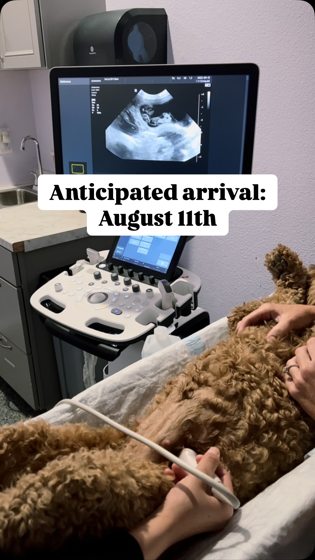 We’ve got the sweetest news to share… 💕
Cali is officially pregnant! 🐾
Mini Goldendoodle pups are on the way, with an expected arrival around August 11th 🐶
These little cuties will grow to be 25–35 lbs of pure joy!
Follow along as we count down to their arrival, witness their precious first moments, and watch them grow during their first 8 weeks with us. From wiggly newborns to playful fluffballs, it’s going to be a beautiful journey 🐶✨
Don’t miss all the puppy milestones! 🐾💗
One Spot Left On Our Reservation List!
We currently have just one spot remaining on our reservation list. If we’re blessed with any additional puppies, we’ll be sure to open up more spots and let everyone know!
Comment “Puppy” below and I will send you our application 🐶🐾
#MiniGoldendoodles #PuppyJourney #Ultrasound #PuppyLove #GoldendoodlePuppies
