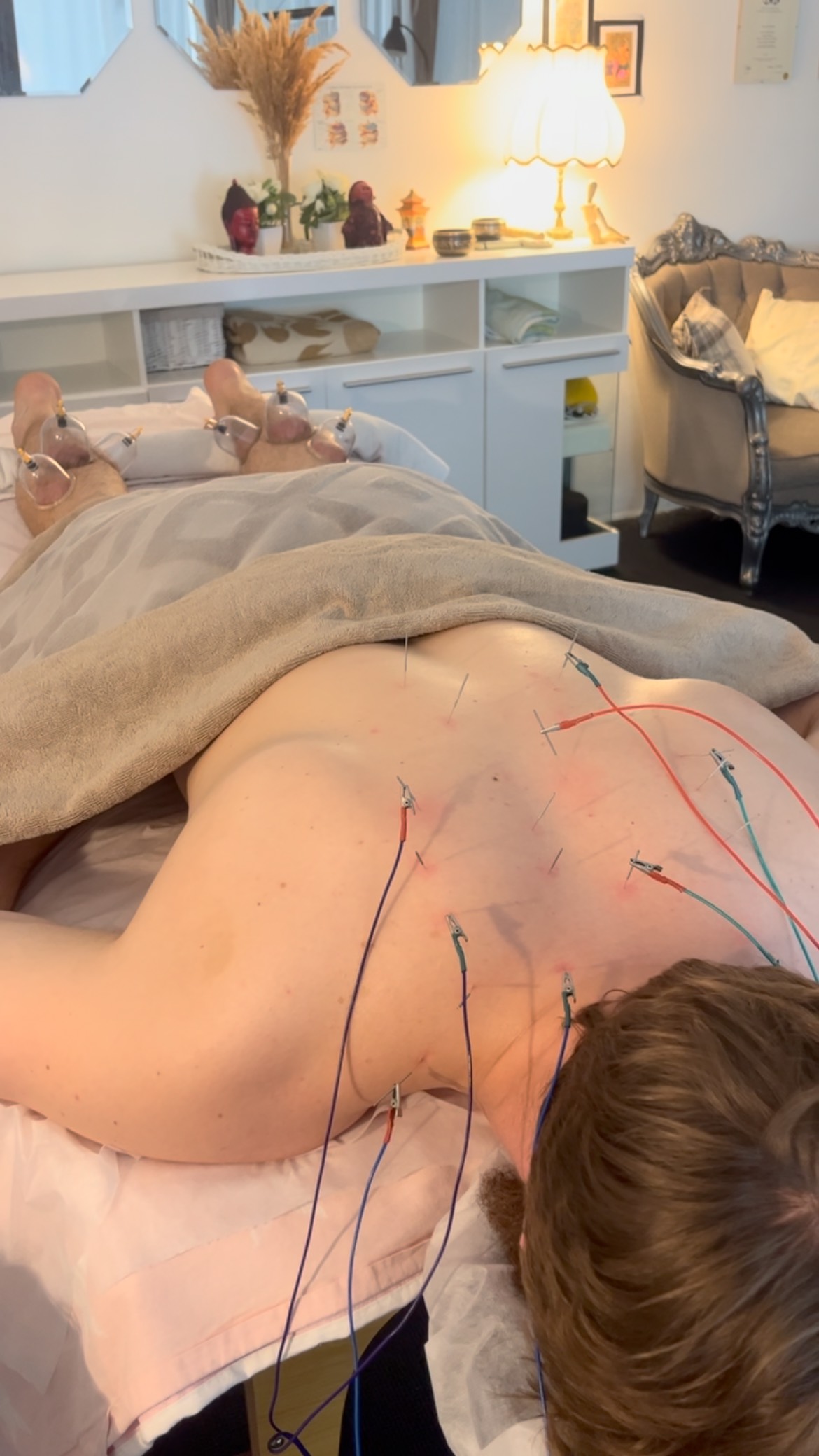 Elektro akupunktūra pečių juostai, įtampai tarp menčių mažinti.
Ši pasyvi raumens stimuliacija puikiai tinka: skausmo malšinimui (lėtiniam ir ūmiam), gerinti kraujotaką ir pagreitinti audinių gijimą, nervų sistemos veiklai- streso mažinimui, virškinimo ir vidaus organų funkcijų gerinimui.