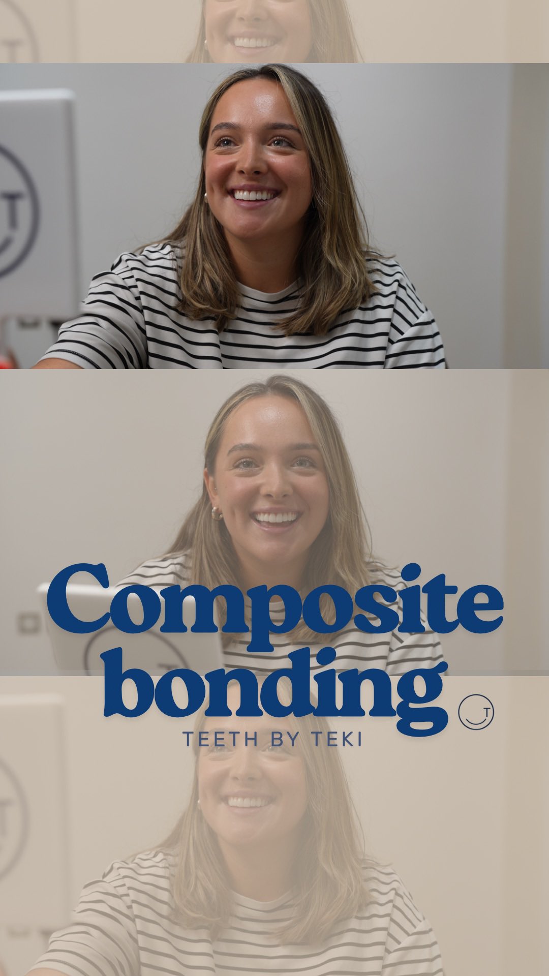 This is what it’s all about….
.
.
Composite bonding at Teeth by Teki. Me and my team are here to give you the best. Appreciate you all
.
.
#teethbyteki #compositebonding #healthyteeth #smilemakeover #smile