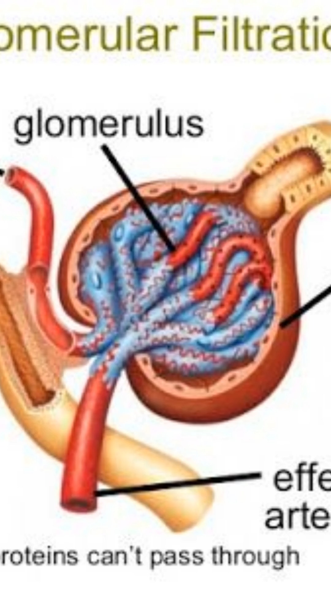 Your Kidneys: The Ultimate Filtration Machine
INCREDIBLE FILTRATION FACTS:
FACT #1: Your kidneys filter approximately 180 liters of blood daily—that's enough to fill a standard bathtub!
FACT #2: They process your entire blood supply over 30 times each day through sophisticated structures called glomeruli.
THE BOUNCER ANALOGY:
Think of glomeruli as incredibly selective, sophisticated bouncers at an exclusive club. They:
✅ Let small waste products (urea, creatinine) pass through into urine
✅ Keep essential substances (proteins, red blood cells) in your bloodstream where they belong
WHEN KIDNEY DISEASE DEVELOPS:
These molecular bouncers become less selective:
❌ Valuable proteins leak out
❌ Waste products build up
❌ The filtration system breaks down
YOUR KIDNEYS ARE AMAZING: This filtration happens 24/7 without you even thinking about it!
📚 References (All in One Section):
Glomerular Filtration and 180 Liters per Day:
Guyton, A. C., & Hall, J. E. (2021). Textbook of Medical Physiology (14th ed.). Elsevier.
National Kidney Foundation. (2023). How Your Kidneys Work. https://www.kidney.org/kidneydisease/howkidneyswrk
Blood Volume Processed Over 30 Times Daily:
Brenner, B. M., & Rector, F. C. (2012). Brenner and Rector's The Kidney (9th ed.).
Giebisch, G. (2004). Renal physiology: mechanisms of glomerular filtration and tubular function. Physiol Rev, 84(2), 365–410. https://doi.org/10.1152/physrev.00038.2003
Function of Glomeruli and Selectivity:
Haraldsson, B., Nystrom, J., & Deen, W. M. (2008). Properties of the glomerular barrier and mechanisms of proteinuria. Physiol Rev, 88(2), 451–487. https://doi.org/10.1152/physrev.00055.2006
Jefferson, J. A., Shankland, S. J., & Pichler, R. H. (2008). Proteinuria in diabetic kidney disease: a mechanistic viewpoint. Kidney Int, 74(1), 22–36. https://doi.org/10.1038/ki.2008.130
Protein Leakage and Waste
Medical Disclaimer: This content is for educational purposes only and does not constitute medical advice. Always consult your healthcare provider for kidney health concerns.
#KidneyHealth #KidneyFacts #Glomeruli #KidneyFunction #EvidenceBasedMedicine #Nephrology #KidneyScience #AmazingKidneys #KidneyDisease #Filtration