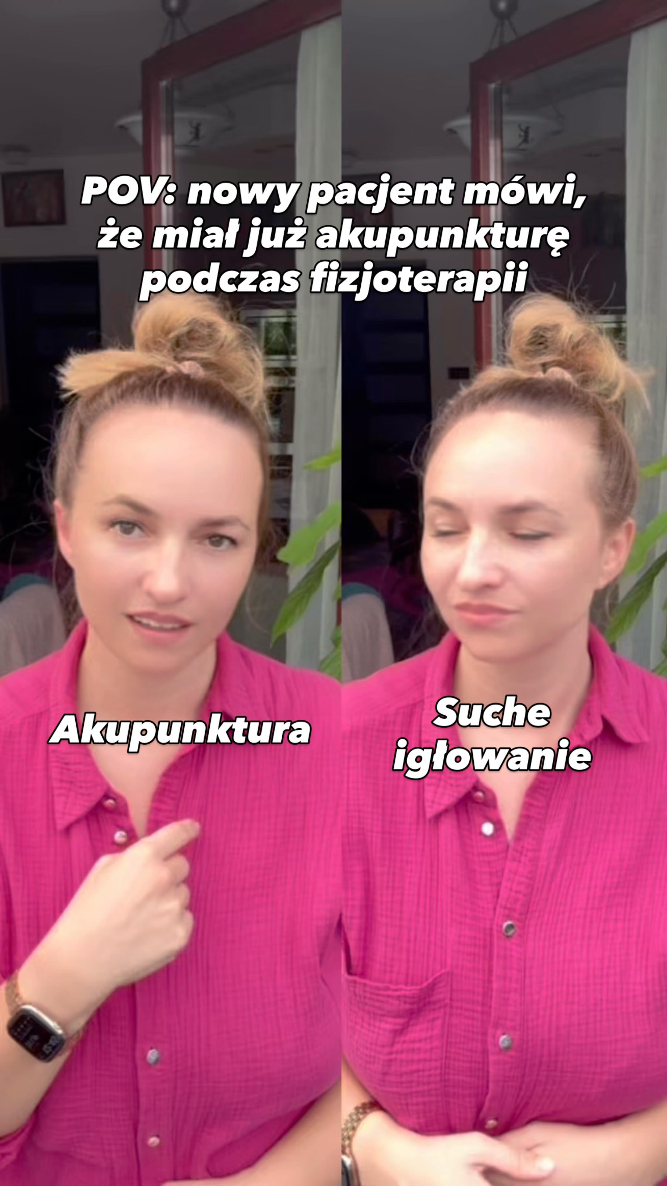 Akupunktura ≠ Suche igłowanie
Choć w obu metodach używa się cienkich igieł, to nie są one tym samym.
🔸 Suche igłowanie skupia się głównie na punktach bólowych i napięciu mięśni – to technika z fizjoterapii. Często używa grubszych igieł i może być bardziej bolesne.
🔸 Akupunktura to element medycyny chińskiej – działa na ciało holistycznie, wpływa nie tylko na ból, ale też na układ hormonalny, emocje, krążenie energii Qi i równowagę całego organizmu. Delikatniejsza technika, cieńsze igły, głębsze działanie.
To dwie różne filozofie działania.
Jeśli szukasz głębszego wsparcia – akupunktura może być tym, czego potrzebujesz.
Zaopiekuj się sobą w Bertha Holistic 🌿
•••••••••••••••••••••••••••••••••••••••••••••••••••
🌱 Wsparcie płodności, zdrowia, emocji, urody.
🌸 Beata Szlachta – ekspert medycyny chińskiej
❤️ Bertha Holistic Centrum medycyny naturalnej we Wrocławiu.
☘️ Akupunktura, zioła, medycyna chińska, terapie twarzy.
•••••••••••••••••••••••••••••••••••••••••••••••••••
• Akupunktura zdrowotna, harmonia, relaks, niepokój, stres
• Akupunktura niepłodność, starania naturalne, ivf, in vitro, ciąża
• Akupunktura estetyczna twarzy, kosmetyczna, kosmetologiczna, uroda
• TCM, Ziołolecznictwo
• Refleksologia, Masaż, Kobido, TRE, Reiki, Hipnoterapia
#sucheigłowanie #fizjoterapia