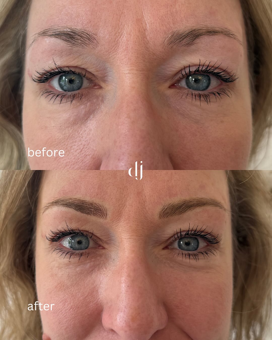 Soft fluffy natural looking before and after hairstroke brows
Available on our booking system via the website
Book today www.daniellejamesclinic.com
#lipblushtattoo #microblading #hyperrealbrows #liptattoo #lipblushtraining #lips #ombrebrows #lipsliverpool #lipscare #pmulips #lipsonfleek #lipsoftheday #lipsonpoint #lipsofinstagram #biglips #beautybar #naturallipblush #semipermanentmakeup #permanentmakeup #daniellejamesclinic #lipblushtraining #lipblushcourse #permanentmakeup #permanentmakeupcourse #naturallipblush #hdlips #pmutraining #lipblushliverpool #lipblushtraininguk #hairstrokeseyebrows