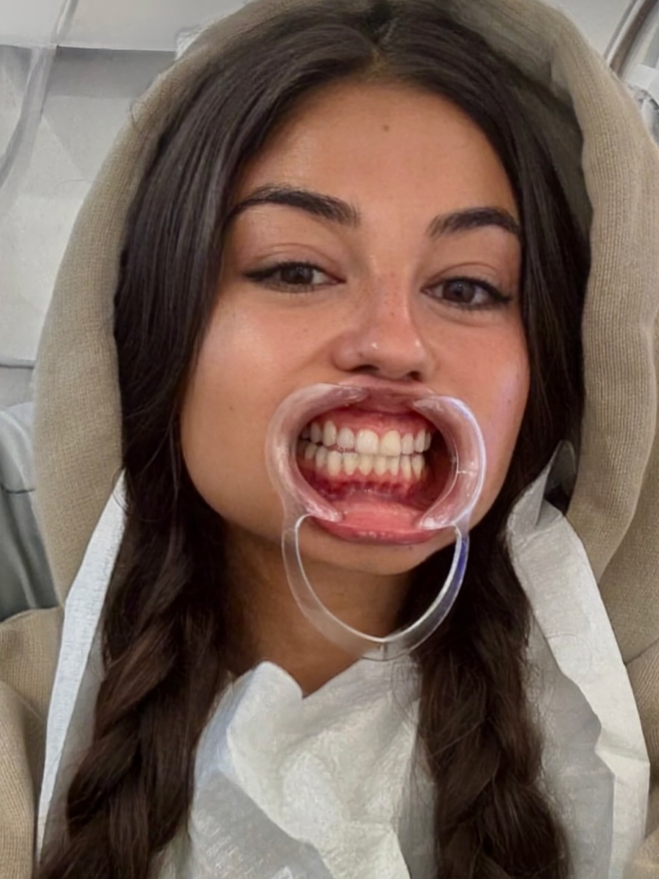 At Beambar, we take “open wide” to a new level.
Anything for that ✨ brighter ✨ smile right? 💁♀️💫 @peachmangojuice