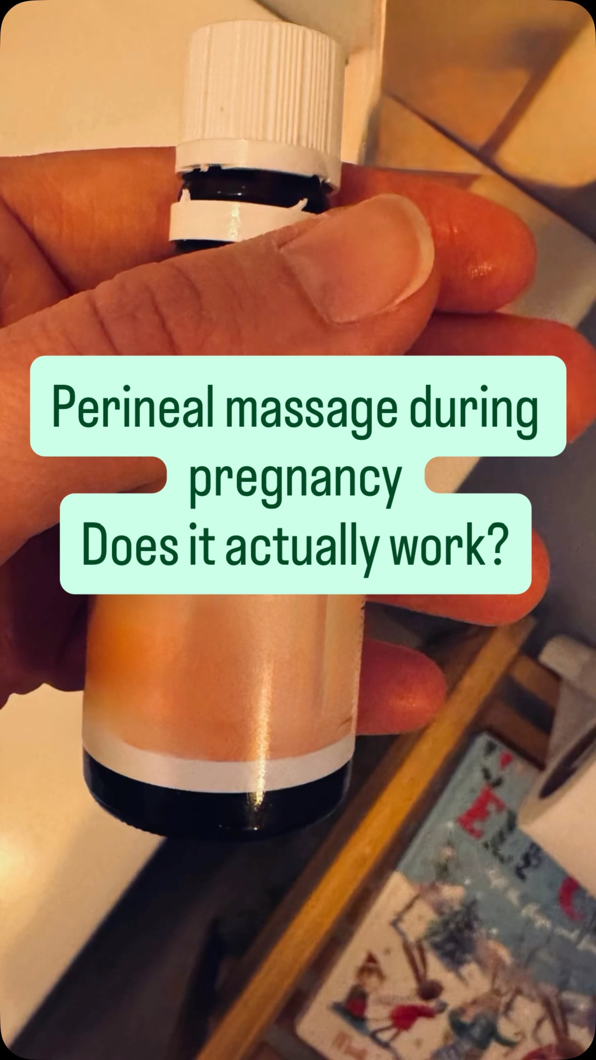 🤷♀️Perineal massage or stretching in pregnancy, is it needed to prevent you having a tear in the birth of your baby?
👉🏻Many women are now informed about this antenatal intervention (including myself as a Midwife). Has been suggested that could reduce the chance of severe tears (3rd & 4th degree) and episiotomy.
Most women tear ~70%, TEARING can be scary, I get that, however some sort of perineal trauma, including grazes and most common tears 50% (1st & 2nd) are part of birth and normally heal well! Severe tears are uncommon (3%).
The biggest risk factors are interventions that may be suggested to you that could increase the likelihood of tearing, and perineal massage reduces this risk of external interventions (i.e. episiotomy).
My point here is that you don’t need an intervention in your pregnancy to prepare you body for stretching, because your body is doing it by the influence of hormones, the waters when intact in labour help to stretch and lubricate the vagina, and to encourage you to connect to your body and your instincts in birthing your baby as you will protect your perineum with instinctive positions, movements, vocalisation & breathing altered or also by choosing water in your labour.
However some women may find that helps them to connect to their body by helping the tissues to become more stretchy and getting used to that sensation.
It is your choice! 💪🏻
doi: 10.1002/14651858.CD005123.pub3.
doi: 10.1016/j.ejogrb.2019.06.011.
Further reading: https://midwifethinking.com/2016/01/13/perineal-protectors/
🇵🇹Precisas de fazer massagem no perineum enquanto grávida para evitares um rasgo no parto?
👉🏻a evidência não indica que esta intervenção reduz a chance de rasgos, mas de episiotomia (1a mãe) e de dor aos 3meses (mãe que pariu antes).
👉🏻Hormonas na gravidez facilitam o vosso corpo a preparar-se para esticar na hora do parto. Assim como a importância do parto fisiológico e da conexão com o vosso corpo e os vossos instintos leva a funções de proteção para minimizar os rasgos.
Os rasgos são muitos comuns ~70% mulheres, os 1’ e 2’ graus ~50% destes 70% (que geralmente curam bem) e os severos ~3%.
É a tua escolha! 💪🏻