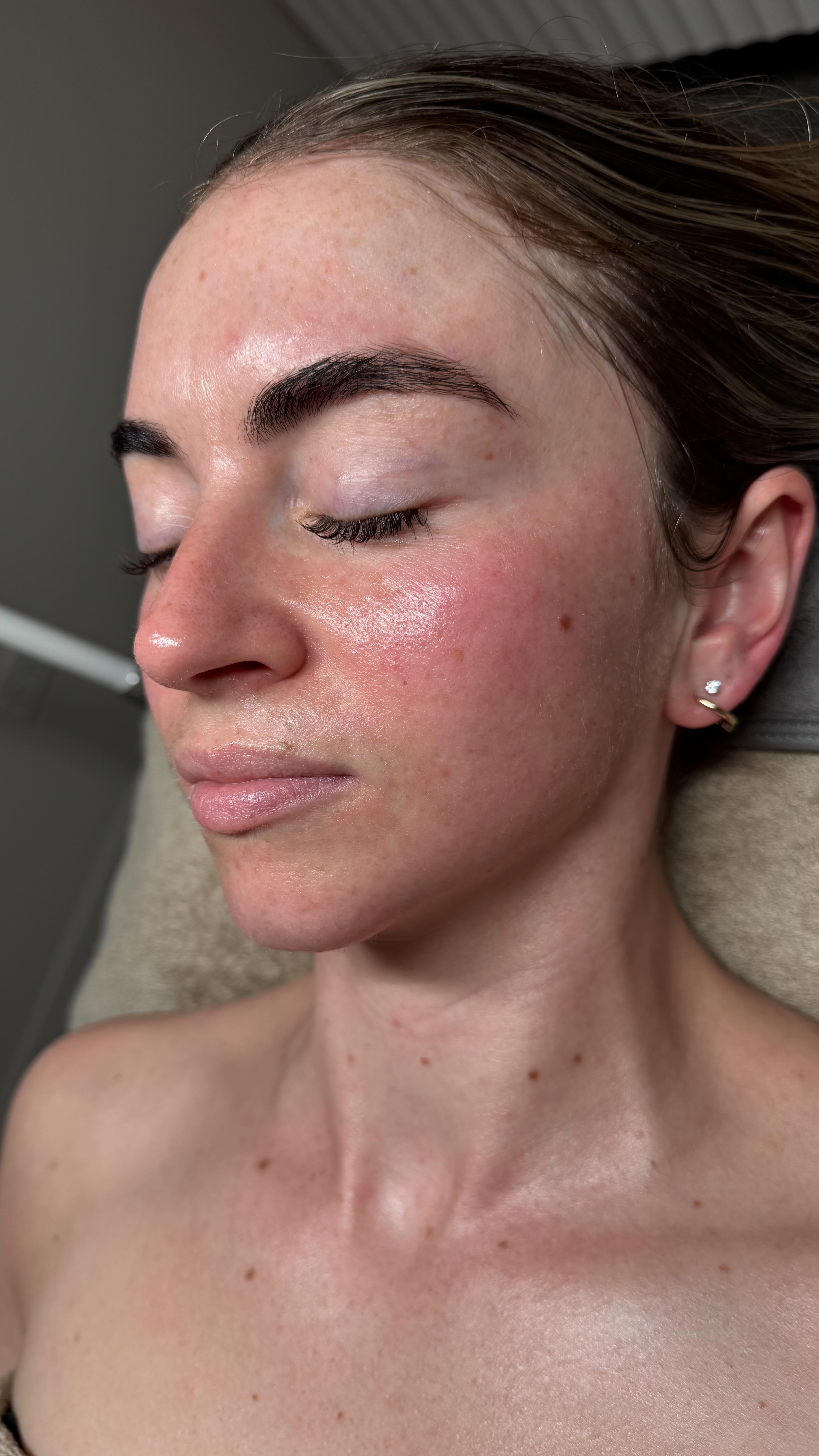 Glow Goals? Achieved.
Your skin is about to love you for this! Here’s what the NEW LumiBright Facial includes:
🫧Start with a gentle double cleanse using our calming cleanser & a warm compress to prep your skin.
😮💨 A deep pore detox with sono cleanse for the ultimate clean.
🪩Two layers of LumiBright Peel to boost brightness and clarity.
💆♀️Relax under Healite LED light therapy while enjoying a soothing décolleté massage.
💧Finish with an Ultraceuticals B2 Mask to lock in hydration and plumpness.
😍Tailored aftercare so the glow lasts
Look at that glow.
•Book this week and take home a FREE B2 Mask!
DM to book | spots are filling fast!
70 minutes | $280