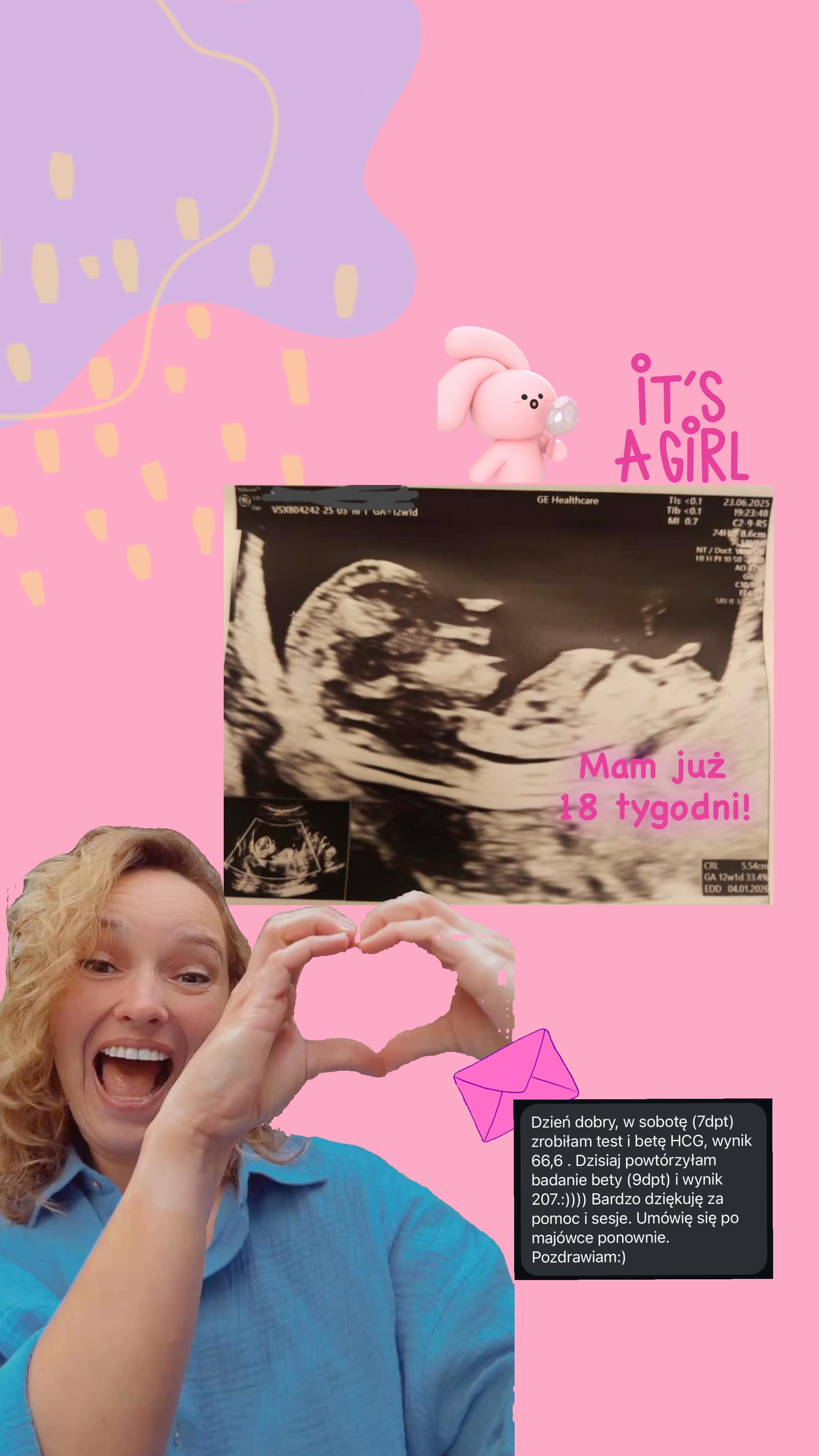 Ta mała księżniczka ma już 18 tygodni 💕
Towarzyszyłam jej mamie od początku przygotowań do transferu – to był cykl sztuczny, z jedynym zarodkiem z procedury i dużą nadzieją w sercu.
Mama mierzyła się wcześniej z trudnościami: PCOS, udrażniane jajowody, poronienie.
A mimo to była gotowa zaufać swojemu ciału i wesprzeć cały proces naturalnymi metodami – w tym akupunkturą i ziołami.
Akupunktura wspierała ją przed i po transferze: pomagała budować dobre endometrium, wspierać krążenie qi i krwi w macicy – tak, aby domek dla maluszka był jak najlepiej przygotowany.
Dodatkowo łagodziła napięcia, balansowała emocje i pomagała utrzymać wewnętrzny spokój w tym intensywnym czasie.
Dziś mamy 18. tydzień i ogromną wdzięczność za to, że mogłam być częścią tej drogi.
📍 Terapia wspierająca płodność? Znajdziesz mnie we Wrocławiu, w @berthaholistic.
Zaopiekuj się sobą w Bertha Holistic 🌿
•••••••••••••••••••••••••••••••••••••••••••••••••••
🌱 Wsparcie płodności, zdrowia, emocji, urody.
🌸 Beata Szlachta – ekspert medycyny chińskiej
❤️ Bertha Holistic Centrum medycyny naturalnej we Wrocławiu.
☘️ Akupunktura, zioła, medycyna chińska, terapie twarzy.
•••••••••••••••••••••••••••••••••••••••••••••••••••
#akupunktura #wrocław #płodność #ivf #invitro #ciąża #medycynachińska #niepłodność #TCM #zdrowiekobiety
#ciąża #ziołolecznictwo #harmonia #transfer