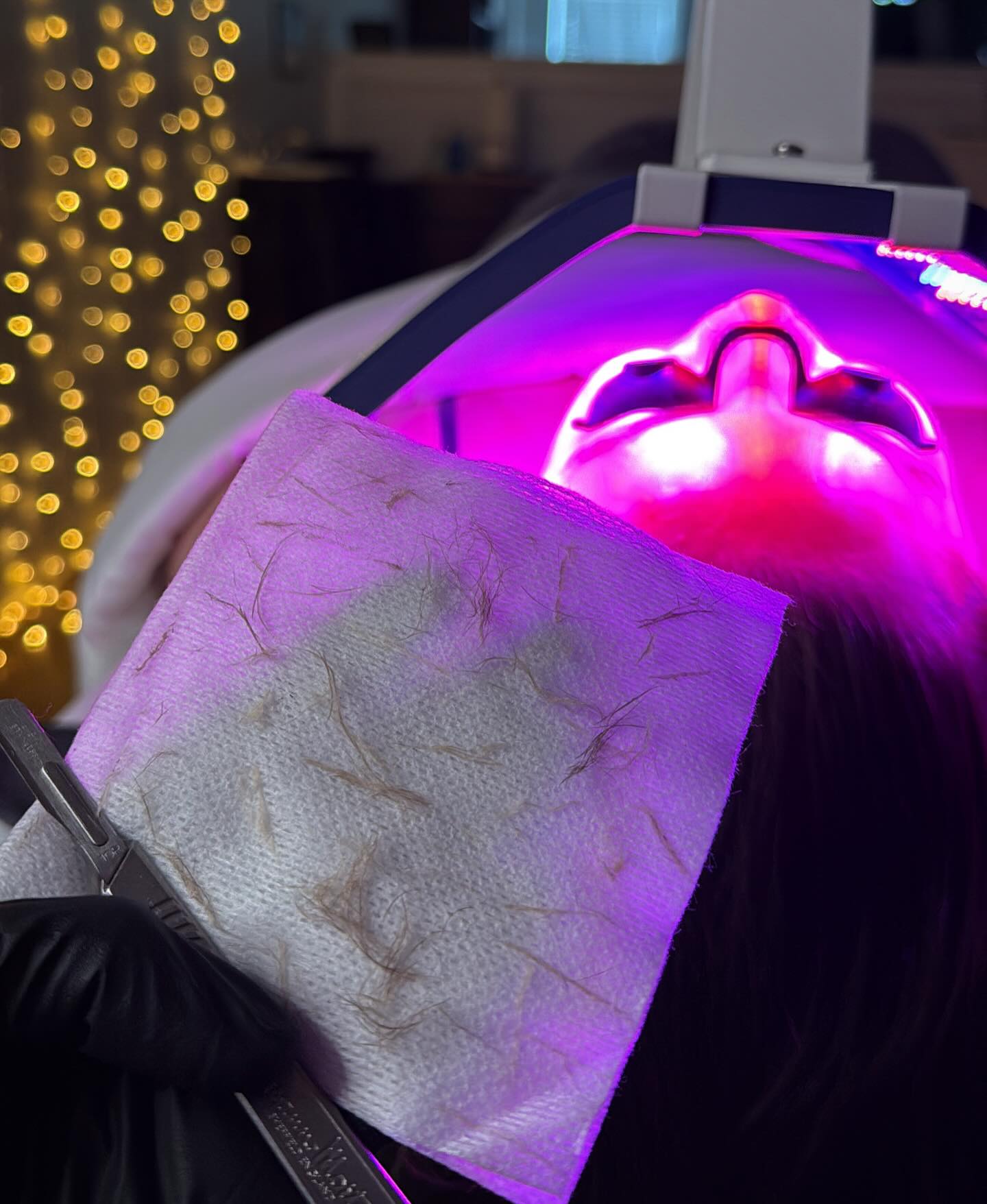 Smoother. Softer. Stronger.
First, we dermaplane — gently removing dead skin cells and peach fuzz to reveal a smoother, brighter surface. Then we follow with red light therapy — soothing inflammation, boosting collagen, and speeding up skin recovery.
Separately, they’re amazing… but together? 🤩
Think glassy, calm, radiant skin that just gets better in the days to come. ✨
Book a Dermaplane Facial Online and add LED Light Therapy now!