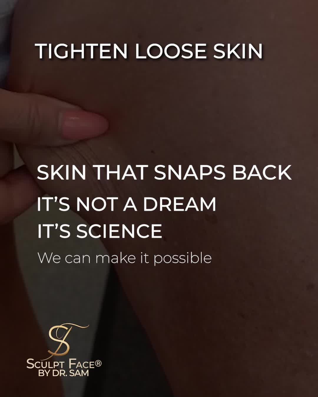 Ever pinch your skin and notice it just… stays there?
That’s a sign of collagen decline and loss of elasticity.
One of the most common changes we see with aging.
The skin no longer "snaps back" the way it used to.
And while that’s natural, it’s not permanent. 💛
At Sculpt Face®, we use advanced non-surgical treatments that stimulate your body’s own collagen and elastin production.
Helping the skin tighten, lift, and renew itself from within.
This is skin tightening, refined with the Sculpt Face Protocol™, the next generation of aesthetic care.
It's time to elevate your glow.
Discover the Sculpt Face Protocol™, a surgical approach to non-surgical rejuvenation.
By 𝓓𝓻. 𝓢𝓪𝓶 𝔁
#SculptFace
#SculptFaceProtocol
#EndoliftUK
#endolift
#endoliftlaser
#endolifting
#endolifttreatment
#endoliftingfacial
#NonSurgicalFacelifts
#SkinRejuvenation
#SkinGoals
#GlowFromWithin
#CollagenBoost
#SkinTightening
#SkinTighteningTreatment
#facialrejuvenation
#laserrejuvenation
#nonsurgical
#aesthetictreatments
#liverpoolaestheticsclinic
#manchesteraestheticsclinic
#leedsaestheticsclinic
#sheffieldaestheticsclinic
#greatermanchesteraesthetics
#cheshireaestheticsclinic