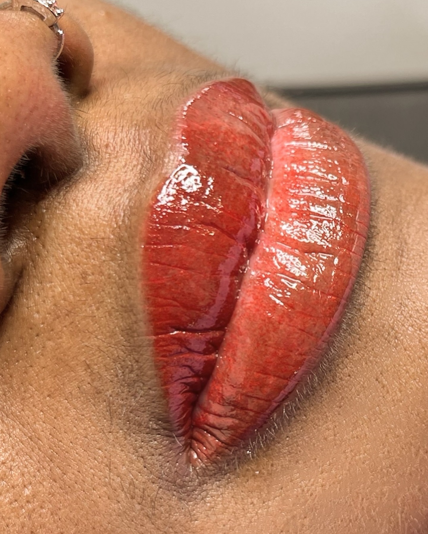 Lip Neutralization Is Done In Stages.
2-4 Sessions Maybe Needed To Layer Ink Pigments And Cancel Out Dark, Cool Or Uneven Hues In The Lips.
This Innovative Service Requires Time And Patience.
The Results Are Worth It!
NO COSMETIC TATTOOING SHOULD HAVE THE GOAL OF TREATING YOU IN ONE SINGLE SESSION. MULTIPLE SESSIONS ARE NEEDED FOR OPTIMAL RESULTS.
#swipeleft Contact Us Today With Inquiries. Click the link in our bio for all details on this service.
BEATANDBLADE.COM
#lipneutralization #darklips #beforeandafter #transformation #tattoo