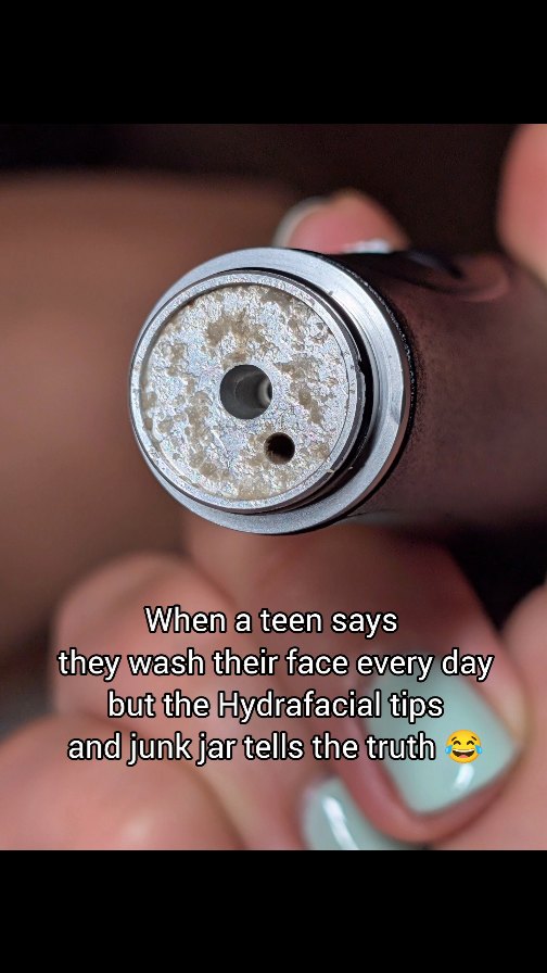 When someone tells me they wash their face every day…
But the Hydrafacial tip and junk jar tell a very different story. 👀
💧This is what comes out:
• Clogged pores
• Dead skin
• Oil and dirt buildup
• Makeup residue
• Pollution you can’t even see
Hydrafacial doesn’t lie — your skin will feel fresh, clean, and actually glow after just one session ✨
📍Book your appointment at LNO Boutique
📩 DM me to schedule or ask questions!
Let your skin tell the right story 💙
#HydrafacialCentennial
#HydrafacialHighlandsRanch
#HydrafacialDenver
#HydrafacialParker
#CentennialFacials
#HighlandsRanchFacial
#DenverFacials
#ParkerFacials
#DenverHydrafacial
#ColoradoHydrafacial
#CentennialEsthetician
#HighlandsRanchEsthetician
#DenverEsthetician
#ParkerEsthetician
#DenverGlow
#HighlandsRanchSkinCare
#lno_boutique