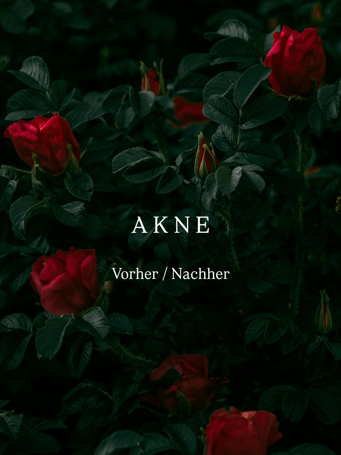 ✨ Bye bye Akne ✨
Du kämpfst mit entzündlicher Haut, Unreinheiten oder Unterlagerungen? Akne betrifft nicht nur Teenager – sondern kann auch im Erwachsenenalter zur Belastung werden.
🔬 In meinem Studio kombinieren wir individuell abgestimmte Aknebehandlungen mit wirkungsvollen Resurfacing-Produkten für eine gezielte Hauterneuerung. So können wir die Haut effektiv klären, Entzündungen reduzieren und das Hautbild sichtbar verbessern.
💆♀️ Für dich bedeutet das:
✔️ weniger Unreinheiten
✔️ verfeinerte Poren
✔️ strahlendere, gesündere Haut
✔️ professionelle Begleitung auf deinem Weg
📅 Buche jetzt deinen Hautanalyse-Termin & starte deine persönliche Skin-Journey.
📍 Huttwil
📲 Link in Bio
#Akne #aknebehandlungen #pharmaceuticals #medicalbeauty