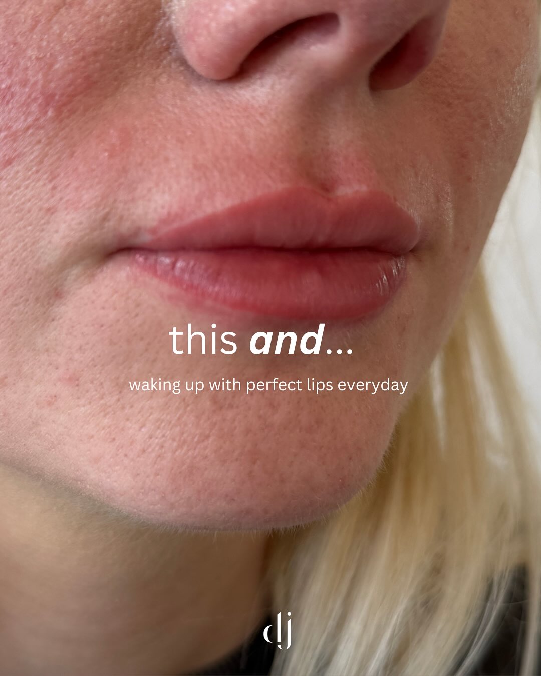 This… and this 👌🏻
What it feels to be lip and brow ready
Remember it’s not an expense it’s self care!
www.daniellejamesclinic.co.uk
Press book to see our availability
✉️ DM us with your enquiries
#lipblush #lipblushing #lipliner #liptattoo #lipblushtraining #lips #lipcare #lipsliverpool #lipscare #pmulips #lipsonfleek #lipsoftheday #lipsonpoint #lipsofinstagram #biglips #lipstain #naturallipblush #semipermanentmakeup #permanentmakeup #nudeblushlips #lipblushtraining #lipblushingtattoo #lipblushartist #lipblushcourse #lipblushingtattoo #lipblushpigments