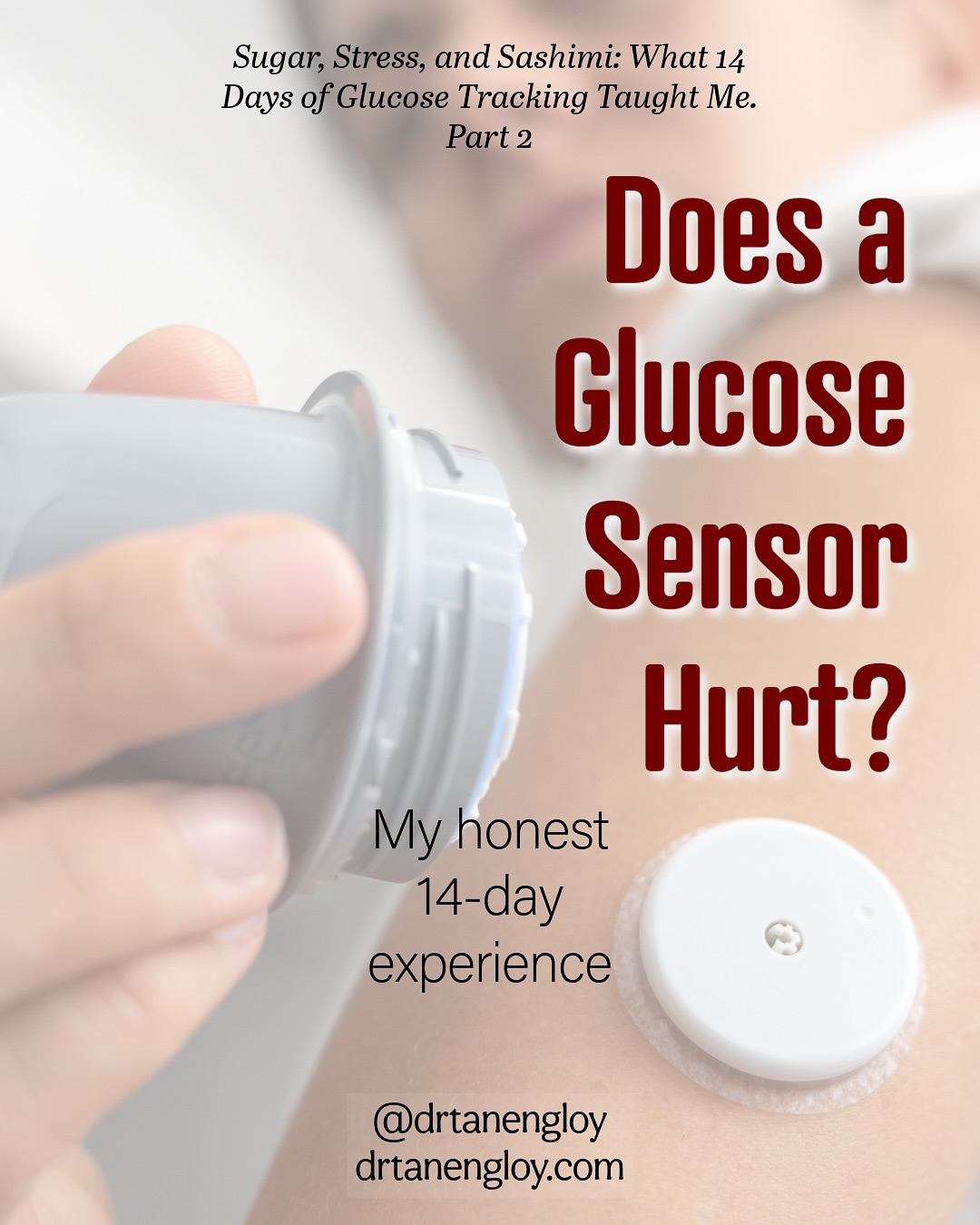 I was told it would be painless. Then I saw the “needle” in the applicator… and had doubts.
To my surprise, applying the glucose sensor didn’t hurt at all. It went on in seconds, stayed secure for 14 days — through swims, cardio kickboxing, and gym workouts — and caused no irritation.
Removing it was simple too, just a bit more adhesive than I expected.
If you’ve ever been nervous about trying CGM, I can honestly say: it’s easier than you think.
👉 Follow for Part 3 next — Sugar, Stress, Durians and Sashimi: What Spiked My Glucose (And What Didn’t)
#gestationaldiabetes #GDM #bloodsugar #glucosemonitor #continuousglucosemonitor #doctorlife #womenshealth #pregnancysg #sgmummy #sgmom #healthysg #sgwellness #sgfitness #diabetesawareness #metabolichealth #nutritiontips #healthyhabits #healthylifestylesg #lowcarblifestyle #lowcarbsg #doctorapproved #sgclinic #doctorsofinstagram #sghealth #wellnesssg #medicalsg #mycgmjourney #sugarstresssashimi #mindfuleating #sgdoctor