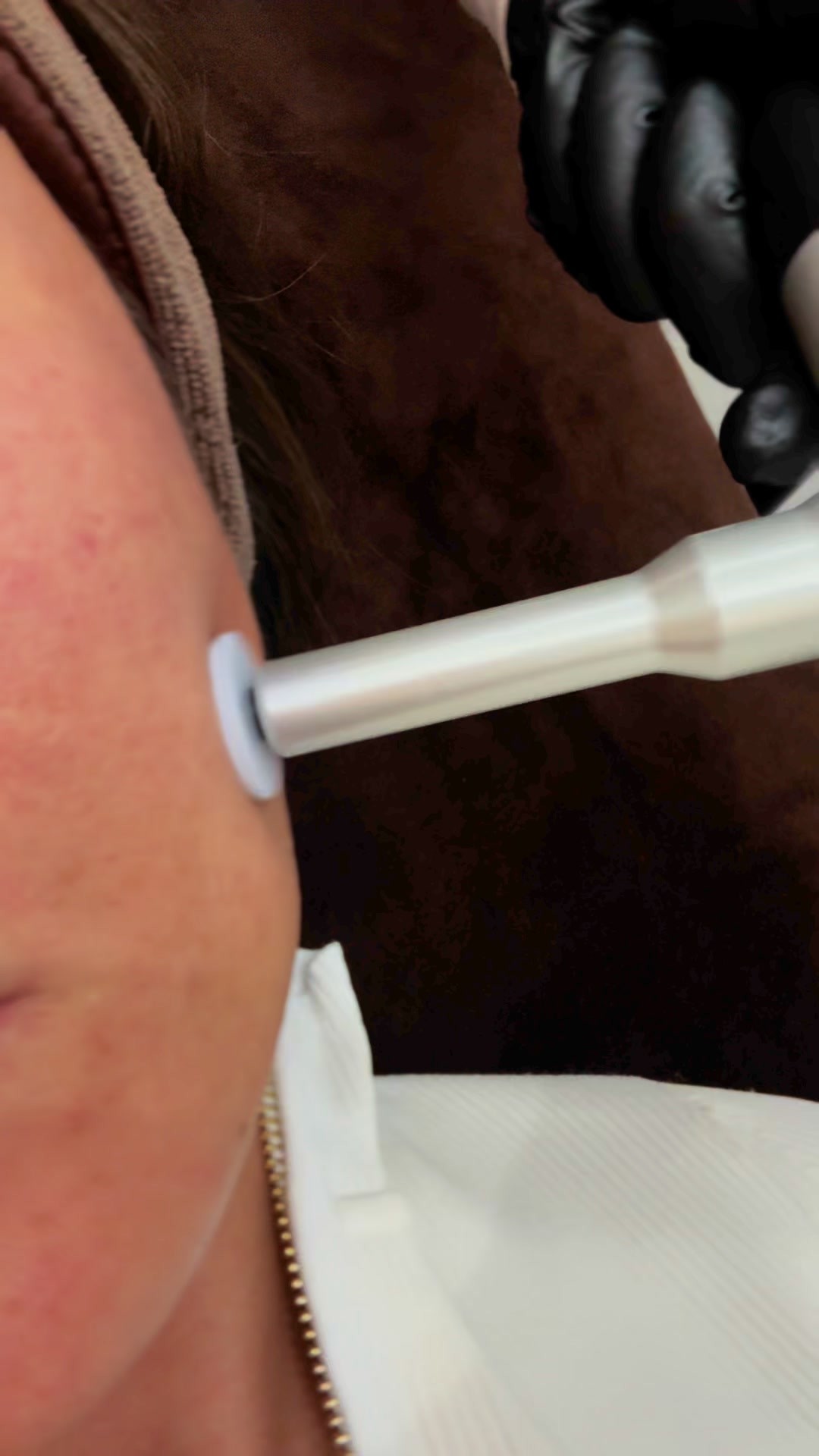 Get your glow on every microneedling touch brings out your skin’s true shine!
🔥 20% 🔥 Code: GIGGLE
#microneedling #Microblading #Microshading #PowderBrows #PermanentMakeup #TattooMakeup #EyebrowTint #BrowLamination #BrowShaping #EyelashExtensions #PasadenaBeauty #AlhambraBeauty #ArcadiaBeauty #PasadenaNails #PasadenaHairstylist #PasadenaLashes #BeautyDeals #GrouponDeals