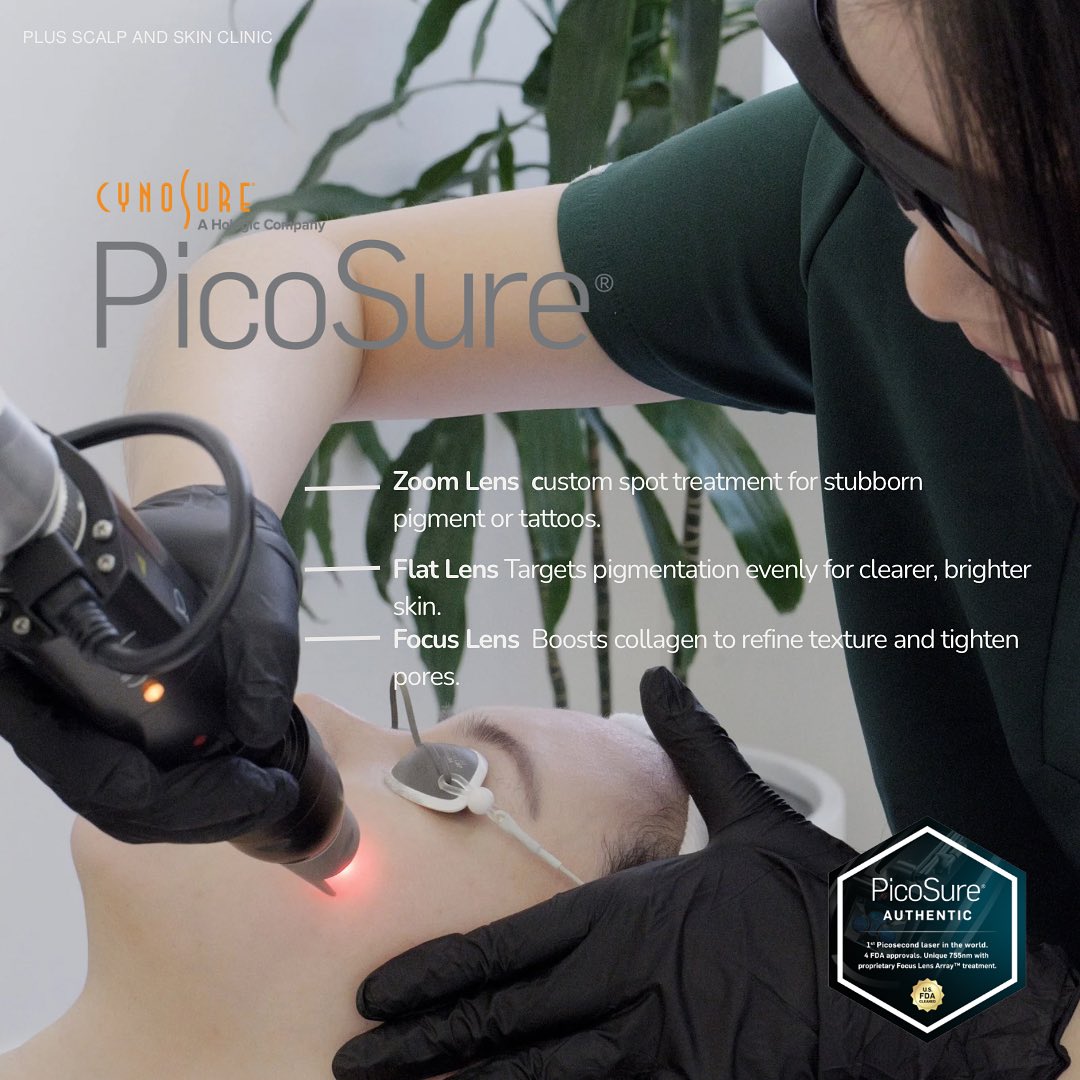 ✨ One Device, Three Times the Power ✨
PicoSure’s Flat, Zoom & Focus lenses work in harmony to transform your skin:
🌟 Flat Lens – Evenly clears unwanted pigmentation for a brighter tone
🎯 Zoom Lens – Targets stubborn spots with precision
💎 Focus Lens – Boosts collagen, smooths texture & refines pores
In one treatment plan, we can target pigment, improve skin quality, and reveal your most radiant complexion — all with minimal downtime.
#picosure #picolaser #malvern #melbourne #toorak #kooyong #pigment #pigmentremoval #melasma #sunspots #sebaceouskeratosis