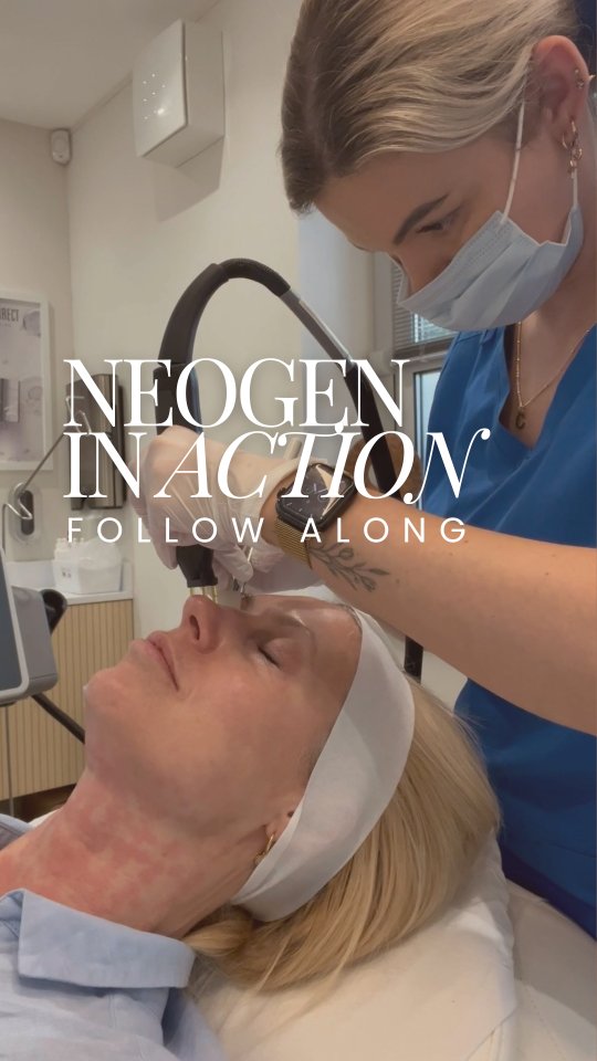 Ever wondered what NeoGen looks like in action?
Follow along with Dr. Hayley as she gets her neck and eyes treated by Charlotte 💥
If you are curious to learn more about NeoGen and what it can do for your skin, book your FREE skin consultation TODAY!
•
•
•
#neogen #eyetreatment #neogenplasma #plasmatreatment #skinrejuvenation #aesthetic #followalong #isleofwight #skintreatment #skinclinic
