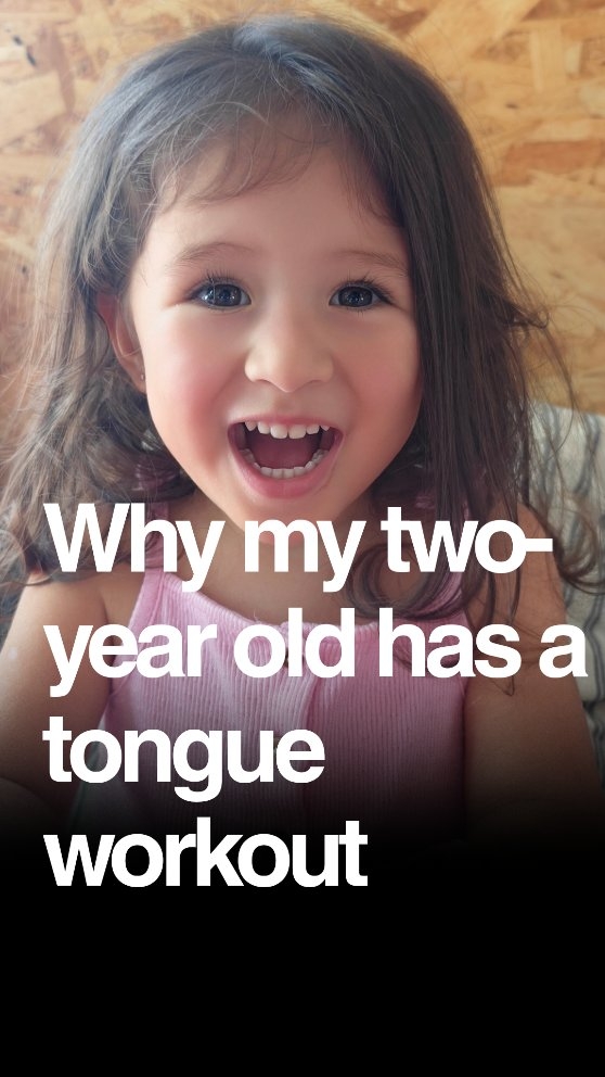 Yes… my 2-year-old is doing myofunctional therapy 👅
This age is not the easiest to work with (toddlers have their own opinions about everything 😅), but with patience, a positive attitude, and making it feel like a game, it’s incredibly rewarding.
What we’re doing:
At this stage, the focus isn’t on ‘perfect form’ — it’s on introducing the tongue, lips, and facial muscles to correct function through playful, simple exercises.
We’re:
Teaching the tongue to rest on the palate (roof of the mouth) instead of the floor of the mouth
Encouraging nasal breathing instead of mouth breathing
Building coordination and strength in the oral muscles
Why it matters:
Nasal breathing supports better oxygenation, which can improve sleep quality and behaviour (Harari et al., 2010 – PMID: 21149436)
Correct tongue posture helps guide proper jaw and airway growth, reducing risk of sleep-disordered breathing (Villa et al., 2015 – PMID: 25791684)
Muscle balance in the mouth, face, and neck supports chewing, swallowing, and speech development (Guimarães et al., 2009 – PMID: 19433240)
These habits also influence the nervous system, gut health, and even brain development by ensuring the body gets the oxygen and structural support it needs.
💡 Small, consistent daily practice now = a lifetime of better breathing, growth, and health.
#BestMyofunctionalTherapist
#BestDentalHygienistDubai
#TopDentalExpertDubai
#MyofunctionalTherapy
#OralFunction
#TonguePosture
#MouthBreathing
#NasalBreathing
#AirwayHealth
#FunctionalDentistry
#OralMyology
#TongueTieAwareness
#FacialGrowth
#PediatricMyofunctionalTherapy
#HealthyKidsDubai
#DubaiMums
#KidsHealthDubai
#WholeBodyHealth
#GutBrainConnection