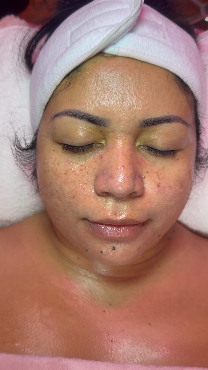 Tuesday Work Just the #After results #Signaturefacial #deepcleansing #takeoutthepores #cleanskin glowing ✨💖