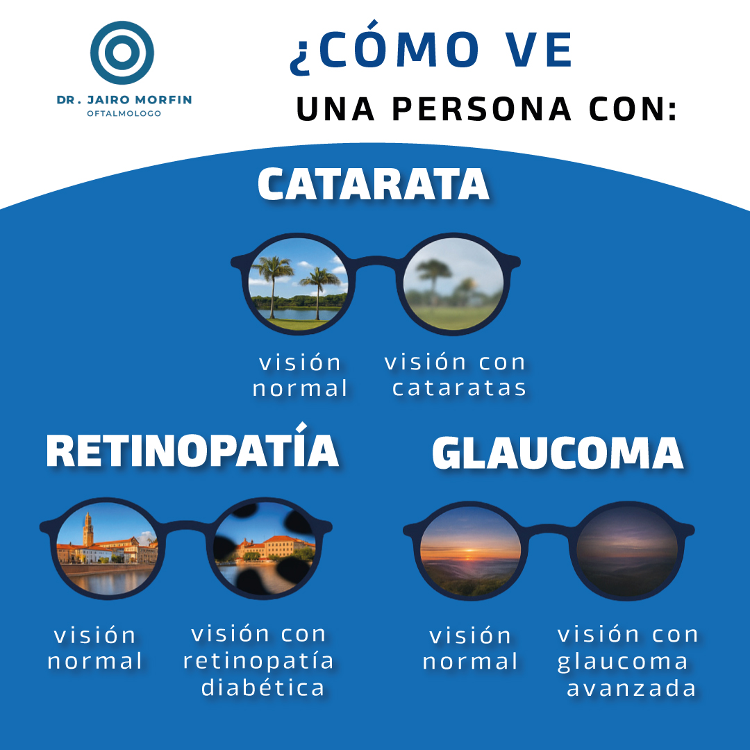 👁 ¿Sabes cómo se ve con catarata, retinopatía o glaucoma?
Detectarlos a tiempo puede salvar tu vista.
📞 33 2823 6510
🌐 oftalmologiaconsciente.mx
#SaludVisual #CuidadoDeLaVista #Prevención