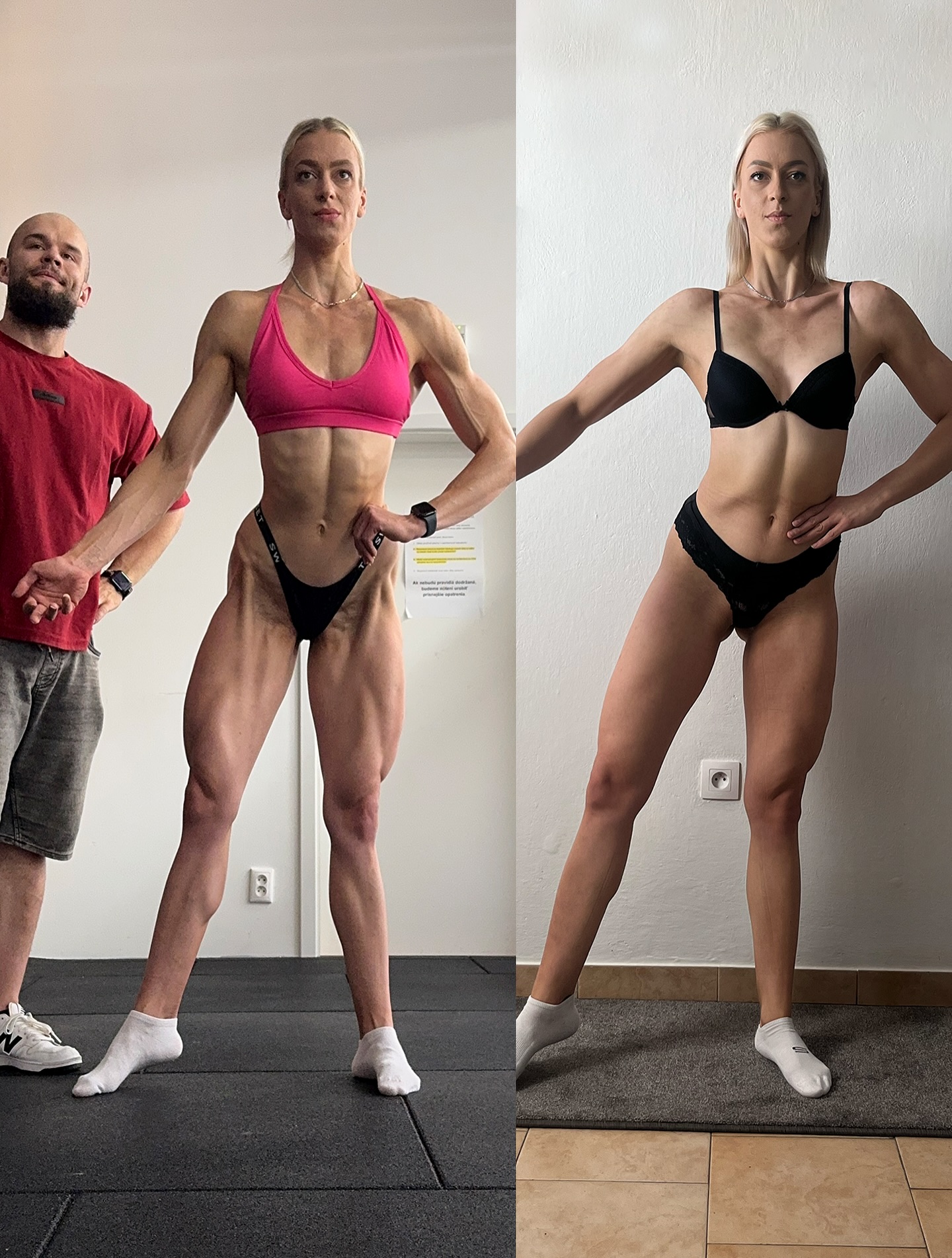 Aktuálny výsledok 1,5 ročnej spolupráce s @_katus01_ prostredníctvom online coachingu. Medzi fotografiami je rozdiel len -1,9kg ☝🏻🤓, avšak v úplne inom pomere svalovej hmoty k tuku. Nerobili sme ani tak rekompozíciu, aj keď výsledkom je pekná rekompozícia. Pracovali sme však na miernom surpluse vyše 14 mesiacov a posledné 4 mesiace sme mierne zredukovali hmotnosť (-6kg).
Katka je inak moja najvyššia zverenkyňa 😄, má 185cm a to je celkom oriešok, keďže biomechanika cvikov kvôli dlhším pákam je častokrát komplikovanejšia. Mimo to aj v kontexte dostatočného vizuálneho osvalenia pre súťažné pódium, v tomto prípade kategória wellness.
Každopádne za 1,5 roka sme z bežnej cvičenkyne spravili športovkyňu po každej stránke. Ešte zapracujeme na slabinách a ja verím, že rok 2026 bude aj pre túto nadanú atlétku súťažnou premiérou 💪🏼😌. Ďakujem za dôveru a ide sa ďalej 🫡.
🖥 služby, referencie, premeny na webe
📚 fitness edukačný obsah na HeroHero
( všetky odkazy v BIO @proste.pista )
zľavový kód @namaximum.sk 👉🏻 𝗣𝗜𝗦𝗧𝗔𝟱
#premena #bodytransformation #transformation #fitnesstransformation #premenatela #wellnessfitness #fitwoman #slovakfitness #fitnessjourney #fitness #fitgirl #girlwholift #womanpower