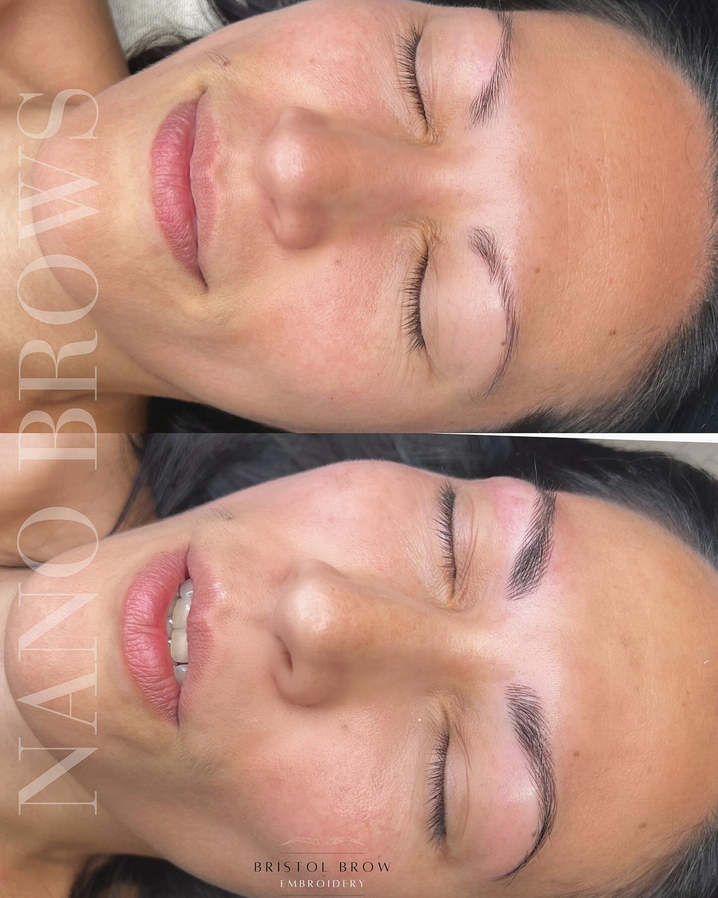 Some very stubborn real hair to blend these Nanos with (you other Brow Techs will know the struggle 🤣) but chuffed with the blend and the natural outcome. What do you think? 🫶
______________________
🗓️ BOOK NOW - Link in Bio (this shows next Availability)
🌐 Further Information on Services & Prices at www.bristolbrowembroidery.co.uk
🏡 Home-Based Studio in Westbury-on-Trym, Bristol
⭐️ Five Star Google Reviews
💬 DM or Text 07920575556 with further enquires
________________________
#hyperrealismbrows
#hyperrealistic #homebasedstudio #bristolmicroblading #bristolbrowembroidery #semipermanentmakeup #microbladingbristol #browsonfleek #bristolbeauty #homebeautystudio #bristolmakeupartist #browtransformation #semipermanentbrows #bristolglam #microbladinguk #homesalon #naturalbrows #sculptedbrows #bristolbeautyservices #bristolbeautytherapist #browenhancement #bristolsemipermanentmakeup #nanobrows #bristolnanobrows #naturalbrows