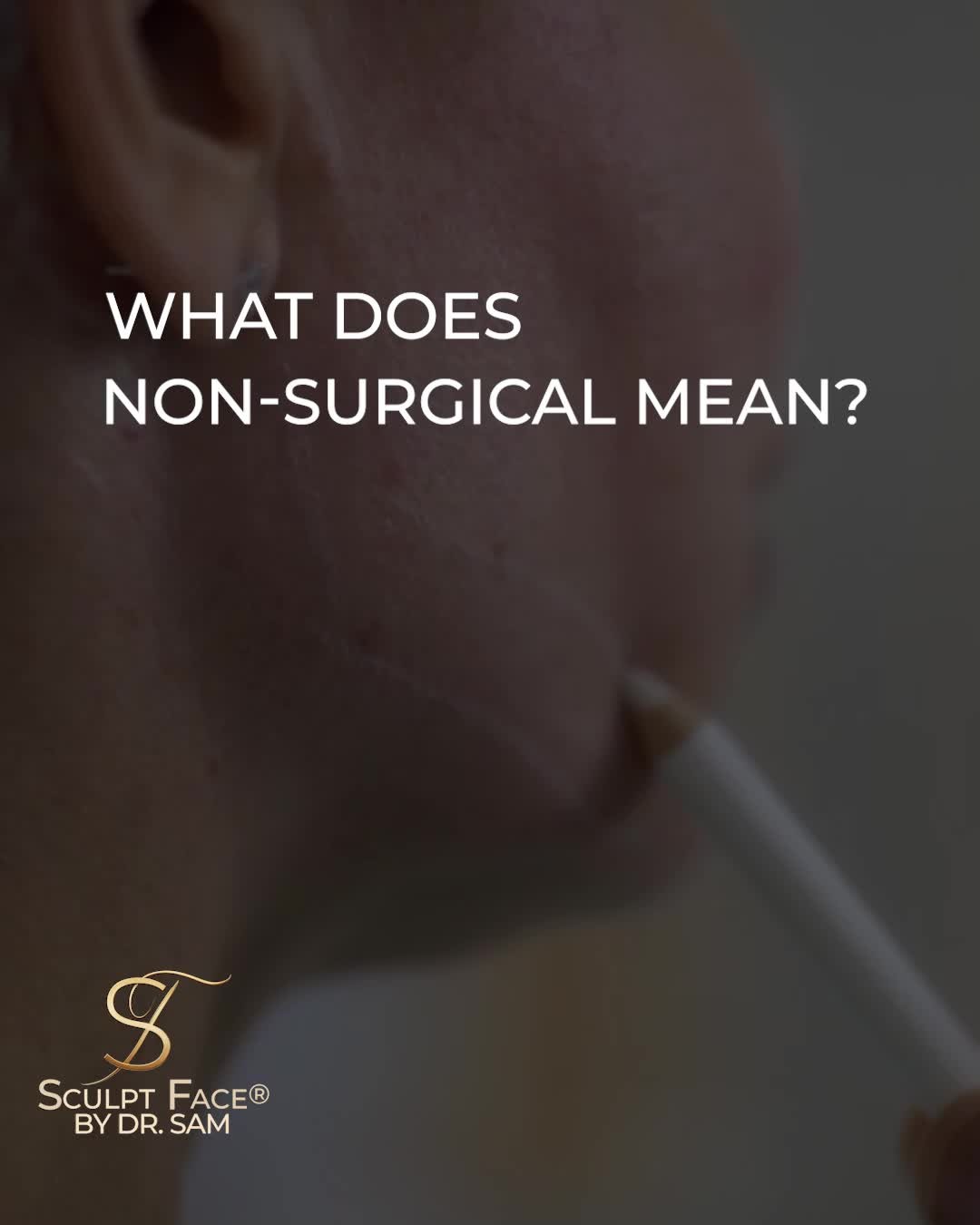 What does “non-surgical” really mean?
It’s a term we hear often, but it can be misunderstood.
Non-surgical does not always mean non-invasive.
At Sculpt Face®, Endolift® is what we do. We don't just offer it, we refine it the Sculpt Face way.
A minimally invasive laser treatment that works beneath the skin’s surface to tighten, lift, and contour.
It’s considered the gold standard for achieving both skin tightening and targeted fat reduction (lipolysis).
With minimal downtime and natural-looking results.
We only use the original Eufoton Endolift® laser and perform every treatment with Dr. Sam’s surgical expertise and up-to-date medical training.
Our goal? Treatments that are effective, safe, and designed around you.
It's time to elevate your glow.
Discover the Sculpt Face Protocol™, a surgical approach to non-surgical rejuvenation.
By 𝓓𝓻. 𝓢𝓪𝓶 𝔁
#SculptFace
#SculptFaceProtocol
#EndoliftUK
#endolift
#endoliftlaser
#endolifting
#endolifttreatment
#endoliftingfacial
#NonSurgicalFacelifts
#SkinRejuvenation
#SkinGoals
#GlowFromWithin
#CollagenBoost
#SkinTightening
#SkinTighteningTreatment
#facialrejuvenation
#laserrejuvenation
#nonsurgical
#aesthetictreatments
#liverpoolaestheticsclinic
#manchesteraestheticsclinic
#leedsaestheticsclinic
#sheffieldaestheticsclinic
#greatermanchesteraesthetics
#cheshireaestheticsclinic