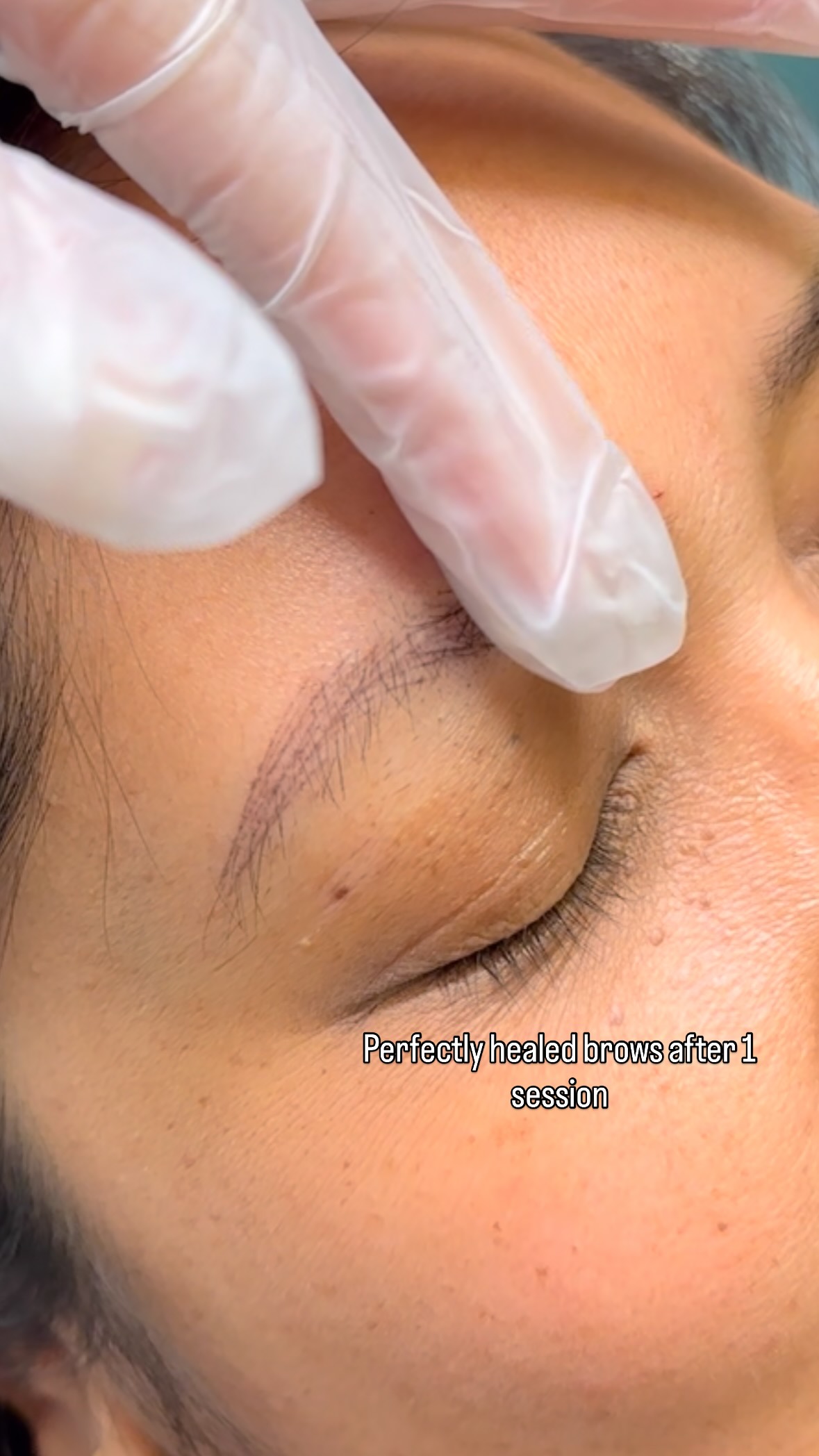 Bold, natural, and long-lasting—this is why I LOVE nano brows! My clients walk out feeling more confident and wake up every day with effortless brows 🙌 Seeing healed results that look soft and natural is the best part of what I do.
Ready for your own brow transformation? ✨ DM me or book through the link in bio.
#NanoBrows #SanMateoBrows #BayAreaPMU #PermanentBrows #WakeUpWithMakeup #NaturalBrows #BrowTransformation #BoldBrows #PMUArtist #PMUStudio #SanMateoBeauty #BayAreaBeauty #BrowsThatLast #ConfidenceInBrows #EffortlessBeauty #PMUBayArea #FemaleOwnedBusiness #WomenOwnedAndProud #SupportSmallBusiness #BrowGoals