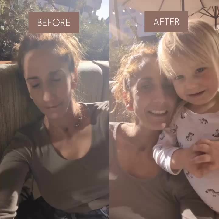 Imagine going from barely getting through the day… 💊 relying on pain meds, missing work, and pushing through constant discomfort—
to ✨ showing up fully for your life, pain-free, energized, and empowered.
That’s the power of truly addressing the root, not just masking the symptoms.
With acupuncture, herbal medicine, and holistic support, your body has the capacity to restore balance and heal.
💫 If you’re ready to move from surviving to thriving, this is your sign.
Send a DM today to begin your own transformation.
#cuppingtherapy #painmanagement #integrativemedicine #tcm #chinesemedicine #moxibustion #acupressure #acupunctureheals #acupuncturerocks #womenhealthcare #womenhealthtips #stressrelief #selfcare #naturalhealing #santacruz