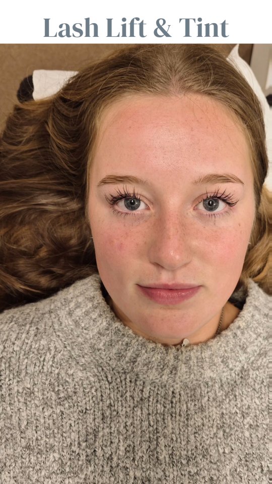 The curl is perfect because even though her lashes are looooong, they don't touch her eyelid.
If you've ever had a lash lift that was over curled or too strong for your eyes, causing them to constantly touch your eyelids, it can put extra stress on your natural lashes — sometimes even making them shed earlier than they should.
That’s why the right curl matters so much with a lash lift. ✨ The goal is a soft, lifted shape that opens your eyes beautifully (without poking or irritating!).
Healthy lashes + the perfect lift = happy eyes 💕
#LashLift #HealthyLashes #ʟᴀsʜʟᴏᴠᴇ