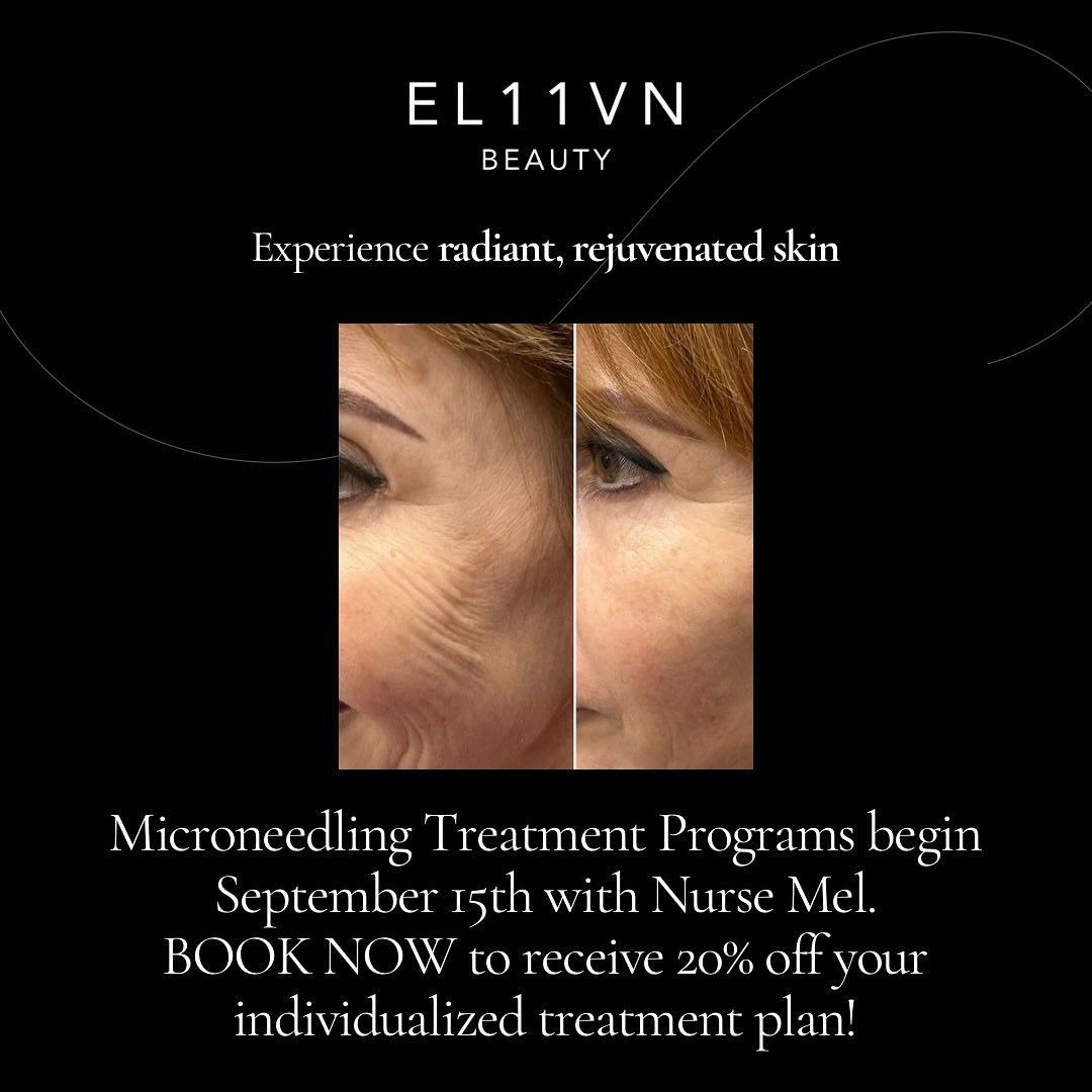 Glow from Within
Microneedling helps reduce acne scars, smooth fine lines, and brighten dull skin. Reveal firmer, more radiant skin with a treatment designed to bring out your natural glow.
📲 Book your consultation with Nurse Mel at @el11vnbeauty. Transformations begin September 15th, 2025—your journey to glowing skin starts now.