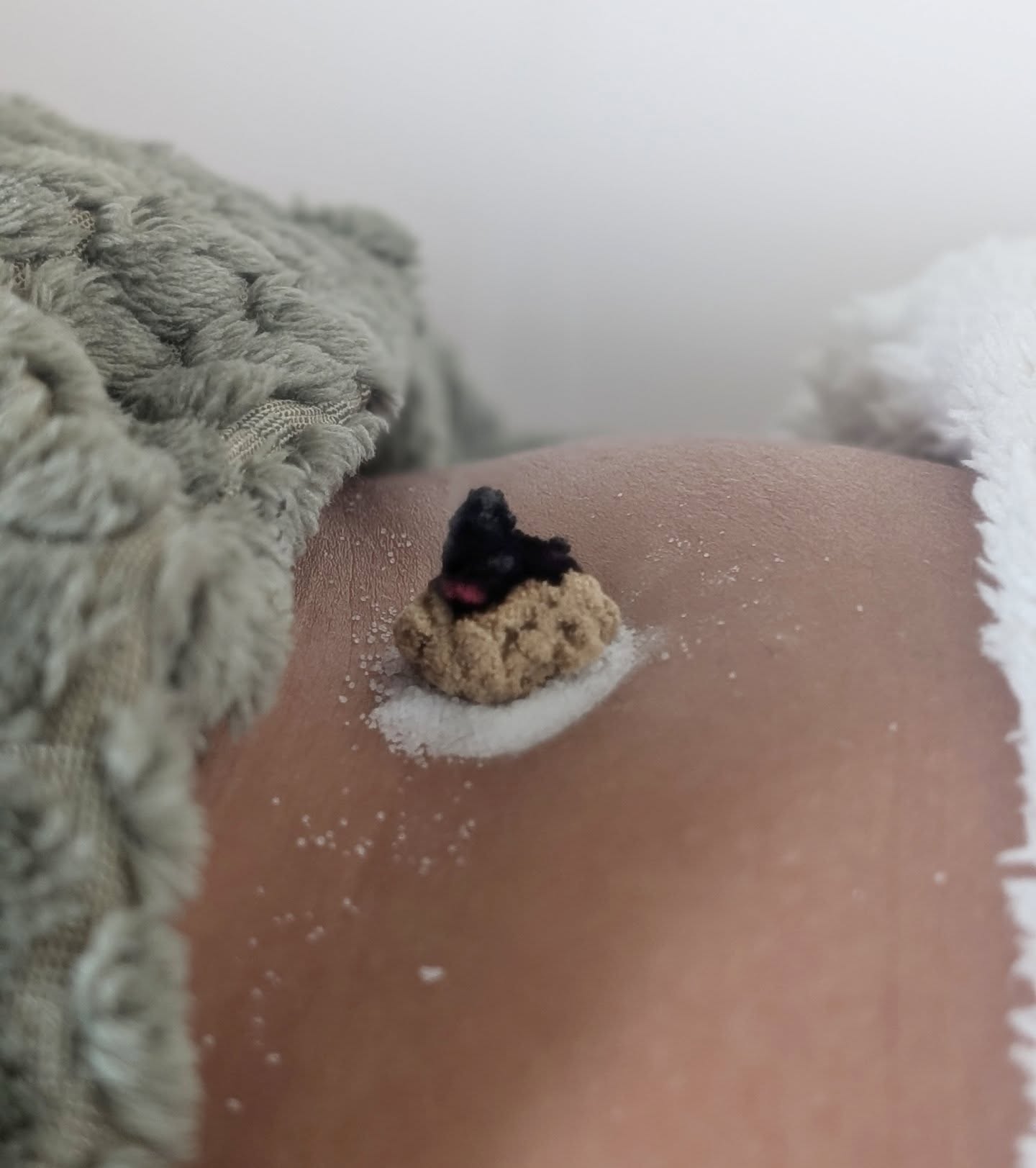 šæ Supporting Yang and Progesterone with Moxa over Ren 8 post Ovulation.
I ā¤ļø this Ancient Medicine
#ancienthealing
#tcm
#chinesemedicineworks
#acupunctureforfertility
#greatermanchester
#bolton
#bury
#lancashire
#ttc
#naturalfertilitysupport