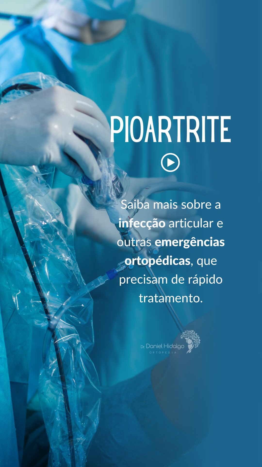 💉Artrite séptica ou artrite piogênica é uma emergência ortopédica e deve ser tratada rapidamente. Descubra um pouco mais sobre ela e outras condições consideradas emergências na área da Ortopedia! #joelho #ortopedia