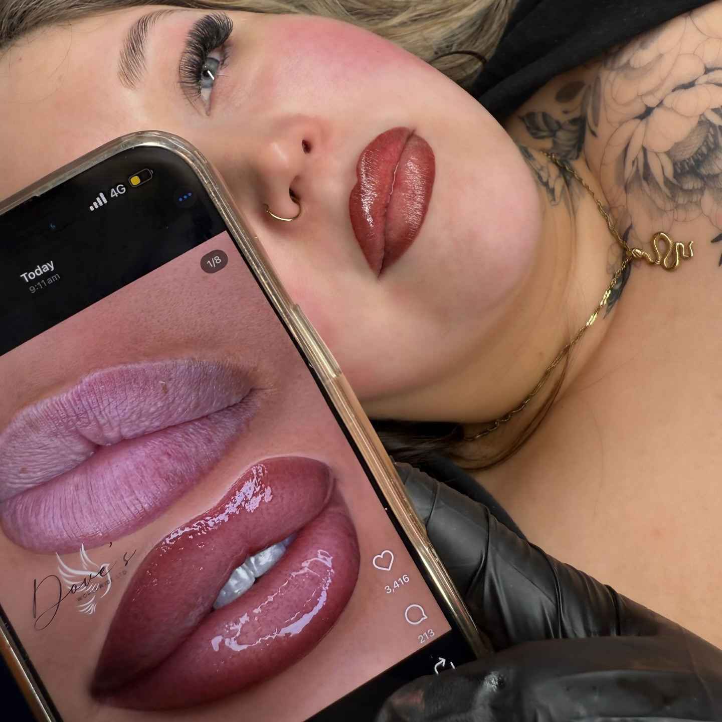 SWIPE SWIPE SWIPE >>>> 😮💨
What she asked for - what she received 🙌🏻
This ombre lip offers is a soft gradient of colour that enhances your natural lips.
These are fresh however once healed will soften and fade into a wearable tint perfect to highlight those lips!
#adelaidebrows #southaus #adelaidebeauty #eyebrow #eyebrows #makeup #beauty #microblading #brows #eyelinertattoo #eyebrowshaping #permanentmakeup #lashes #cosmetictattooadelaide #pmu #brow #cosmetictrainingadelaide #PMUtraining #adelaidepmumasterclass #eyebrowtattoo #micropigmentation #browsonpoint #northadelaide #nanobrowsadelaide #nanotattoo #tattooremoval #laser