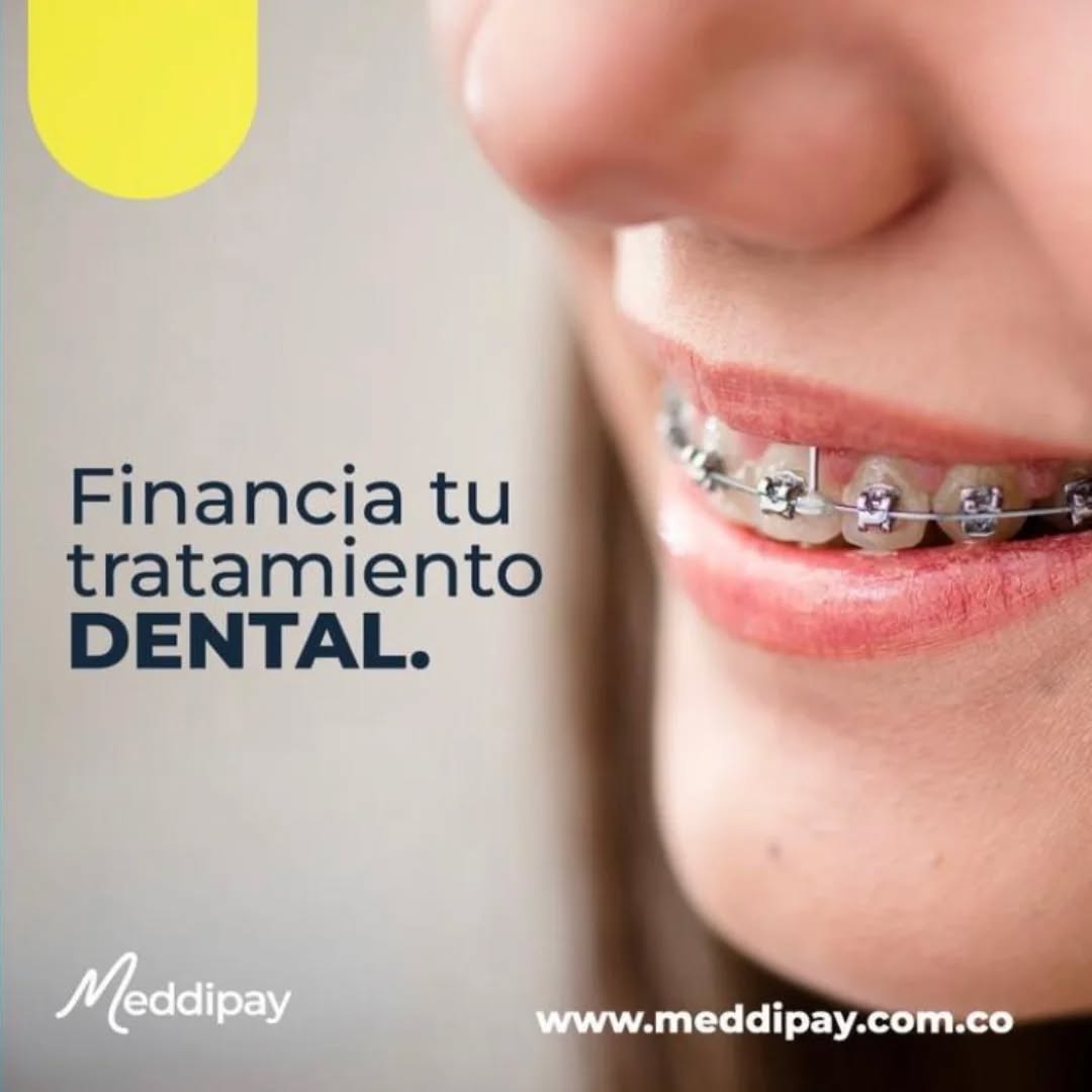 📢 ¡Gran noticia para nuestros pacientes!
En DentiCali pensamos en ti 👉 ahora puedes pagar tu tratamiento dental a cuotas gracias a nuestro nuevo aliado de financiamiento.
¡Sonríe hoy, paga fácil mañana! 💙
Contáctanos para mayor información
👉📱3042167585/3178061353