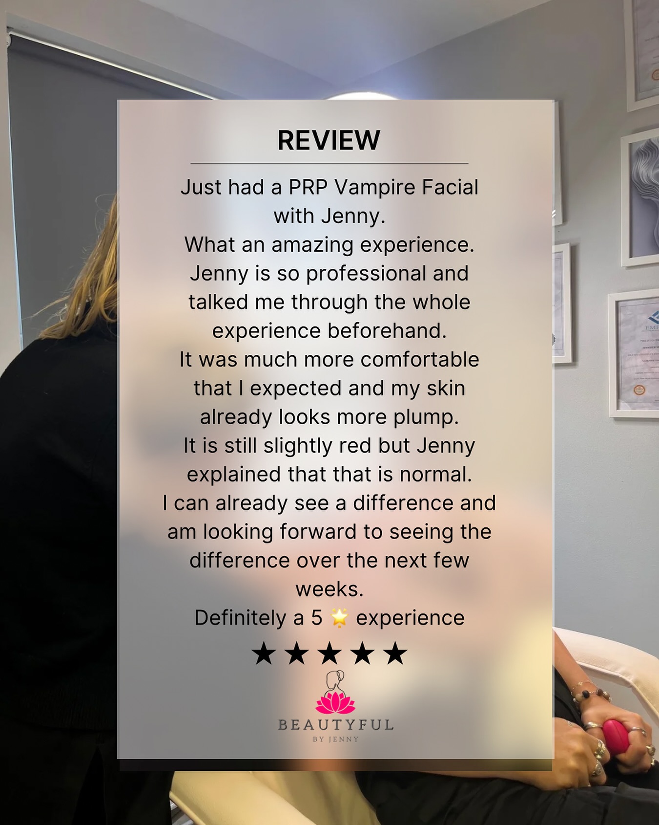 I love hearing how confident our clients feel after their treatments!
Hereโs a recent PRP review i just had to share. โจ
Ready to boost your own glow? Book your PRP session today and get the glow up you deserve ๐ซถ
