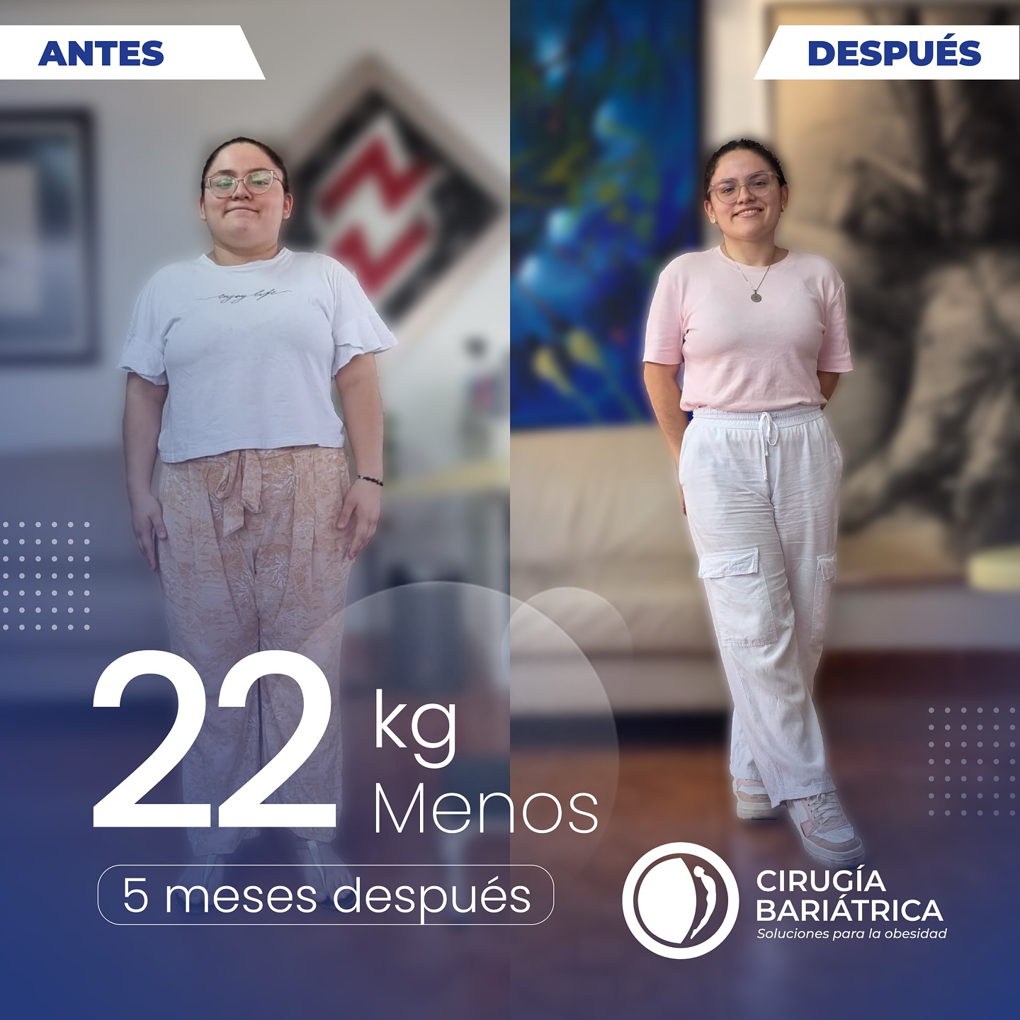 ✨ 22 kilos menos en solo 5 meses ✨
Gracias a la cirugía bariátrica del Dr. Eduardo Bolaños y su equipo de trabajo, nuestra paciente transformó su vida con el respaldo de un grupo de profesionales que se destaca por su compromiso, ética, tecnología de vanguardia y una calidad humana inigualable.
El profesionalismo del Dr. Bolaños y su equipo hace posible que cada historia de éxito sea una realidad. 💙💪
✨ 48 pounds lost in just 5 months ✨
Thanks to the bariatric surgery performed by Dr. Eduardo Bolaños and his dedicated team, our patient has transformed her life with the support of professionals who stand out for their commitment, ethics, cutting-edge technology, and unmatched human quality.
The professionalism of Dr. Bolaños and his team makes every success story possible. 💙💪
#surgery #bariatric #bariatricsurgery #cirugiabariatrica #health #healthy #healthandwellness #weightlosssurgery #weightlossjourney