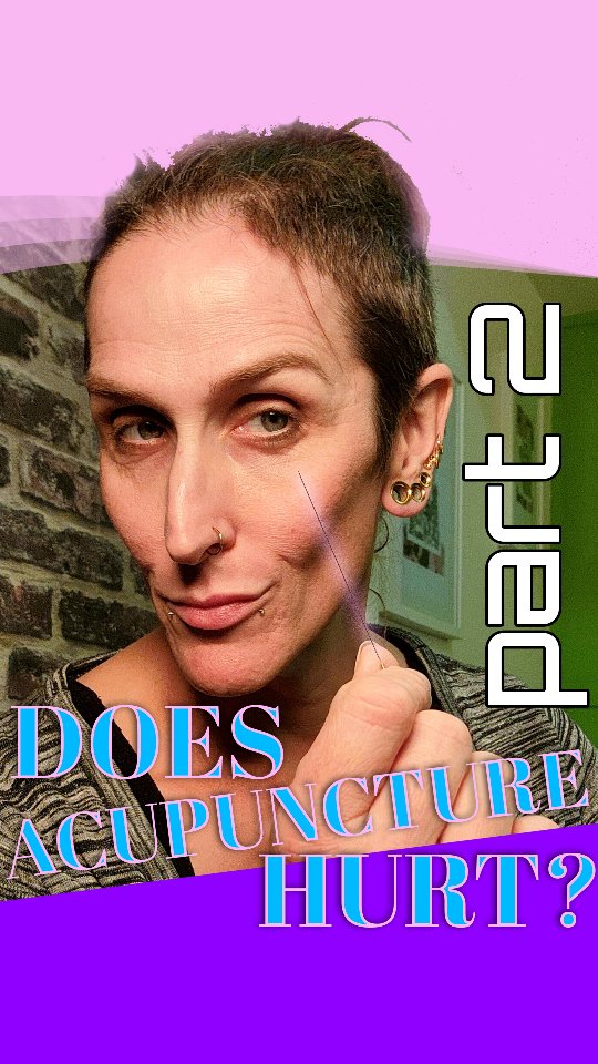 Does acupuncture hurt? Find out here...
#acupuncture #doesithurt #needles #explainervideo