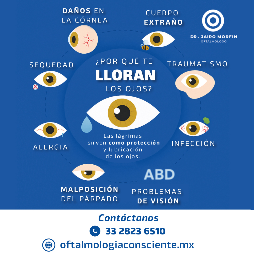 💧 ¿Ojos llorosos?
No siempre es por emoción, puede ser señal de problemas oculares.
Haz tu revisión y cuida tu salud visual.
📞 33 2823 6510
🌐 oftalmologiaconsciente.mx
#SaludVisual #Oftalmología #CuidaTusOjos #Prevención