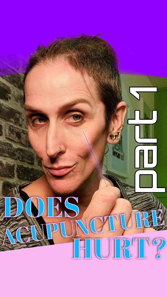 Does acupuncture hurt? Find out here...
#acupuncture #doesithurt #needles #explainervideo