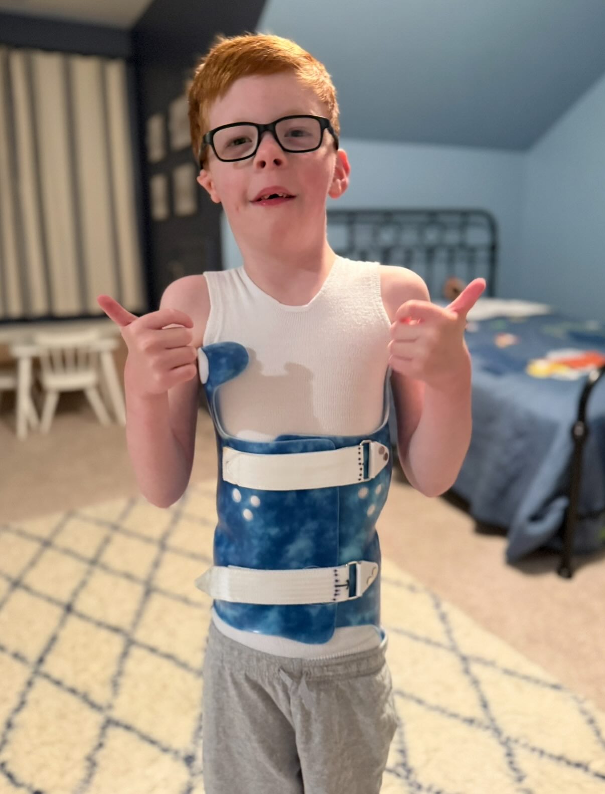 Yesterday we got good news. 💙🩻
Nolan’s new brace is working better than we could have imagined. His top curve has gone from 23° to 13°, and his bottom curve from 18° to 7°!!!
These last four months have been full of long nights, hard work, and a little boy who refuses to give up. He still has to wear the brace at night, but today feels like proof that his determination, and the incredible doctors who guide us, are making a difference.
Thank you to everyone who sent videos and encouragement. Your love helped carry us through.
As a mom, watching Nolan fight through something he never asked for has been humbling. This journey reminds me daily that hope is real, progress is possible, and that perseverance, no matter how small the steps, always matters. 🌟
#hopeinthehard #scoliosisstrong #nolanrandallmoore