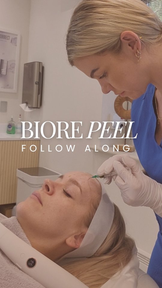 Real results, real glow ✨
Charlotte talks us through the BioRePeel & why we love it!
🌿 Brightens dull skin
🌿 Lightens pigmentation & evens skin tone
🌿 Smooths texture
🌿 Clears congestion
No downtime — just fresh, radiant skin from the very first session 💛
Would you love this for your skin? Comment 'GLOW' below, and we can send you all the details 👇
•
•
•
#chemicalpeel #skinpeel #biorepeel #feelgood #glow #skintreatment #skinglow #skinclinic #fresh #pigmentation #acne #texture #aestheticclinic #followalong #iow #glowyskin #isleofwight