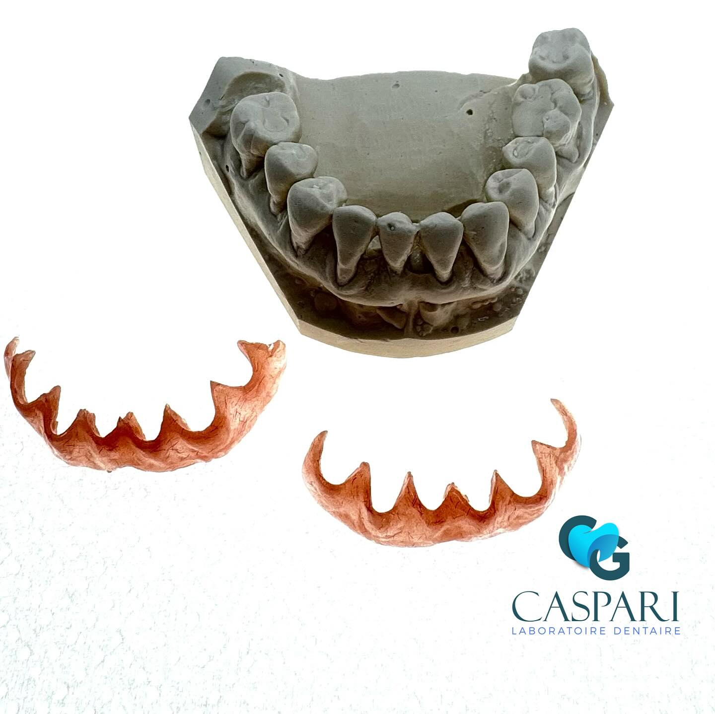 #Epithesegingivale #epithese #paro #estética #hestétique #dent #labodentaire #parodontie #gencive #gummi #resine #sourire #dentblanche #dent #blanc #gencive #rose