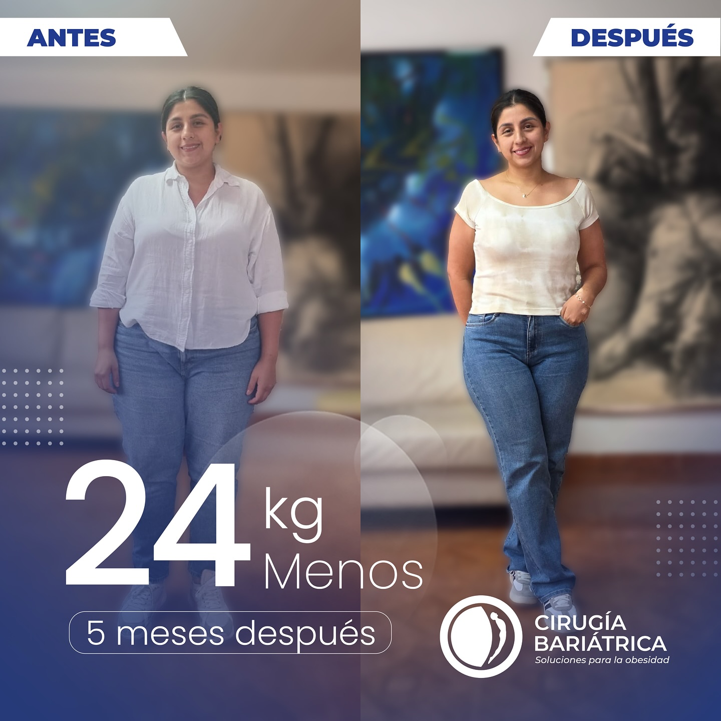 ✨ En solo 5 meses, nuestra paciente logró bajar 24 Kg gracias al compromiso, la excelencia y la calidad del Dr. Eduardo Bolaños y todo su equipo de trabajo. 💙👨⚕️👩⚕️
Cada resultado es el reflejo de profesionalismo, experiencia y dedicación en todos los sentidos. Gracias por confiar en nosotros. 🙌
✨ In just 5 months, our patient lost 53 pounds thanks to the commitment, excellence, and quality of Dr. Eduardo Bolaños and his entire team. 💙👨⚕️👩⚕️
Every result reflects professionalism, experience, and dedication in every sense. Thank you for trusting us. 🙌
#bariatric #bariatrica #bariatricsurgery #weightlosssurgery #weightlossjourney #health #healthandwellness #healthyliving #healthychoices