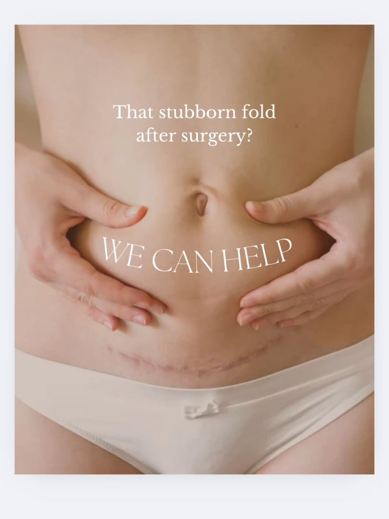 🤍 C-Section Recovery & Manual Therapy 🤍
Had a C-section? Healing goes beyond the scar you see. ✨
Manual therapy can gently release tension, soften scar tissue, and help you reconnect with your core + pelvic floor.
💫 Benefits:
✔️ Reduces pain & tightness
✔️ Improves circulation & mobility
✔️ Restores confidence in movement
✔️ Supports long-term postpartum wellness
Always check with your doctor before starting scar or manual therapy (usually safe after 6–8 weeks once the incision has healed). 💕
🌸 Your scar tells your story—but it doesn’t have to hold you back. 🌸
#CSectionRecovery #PostpartumHealing #ScarRelease #PelvicHealth #StrongMamas