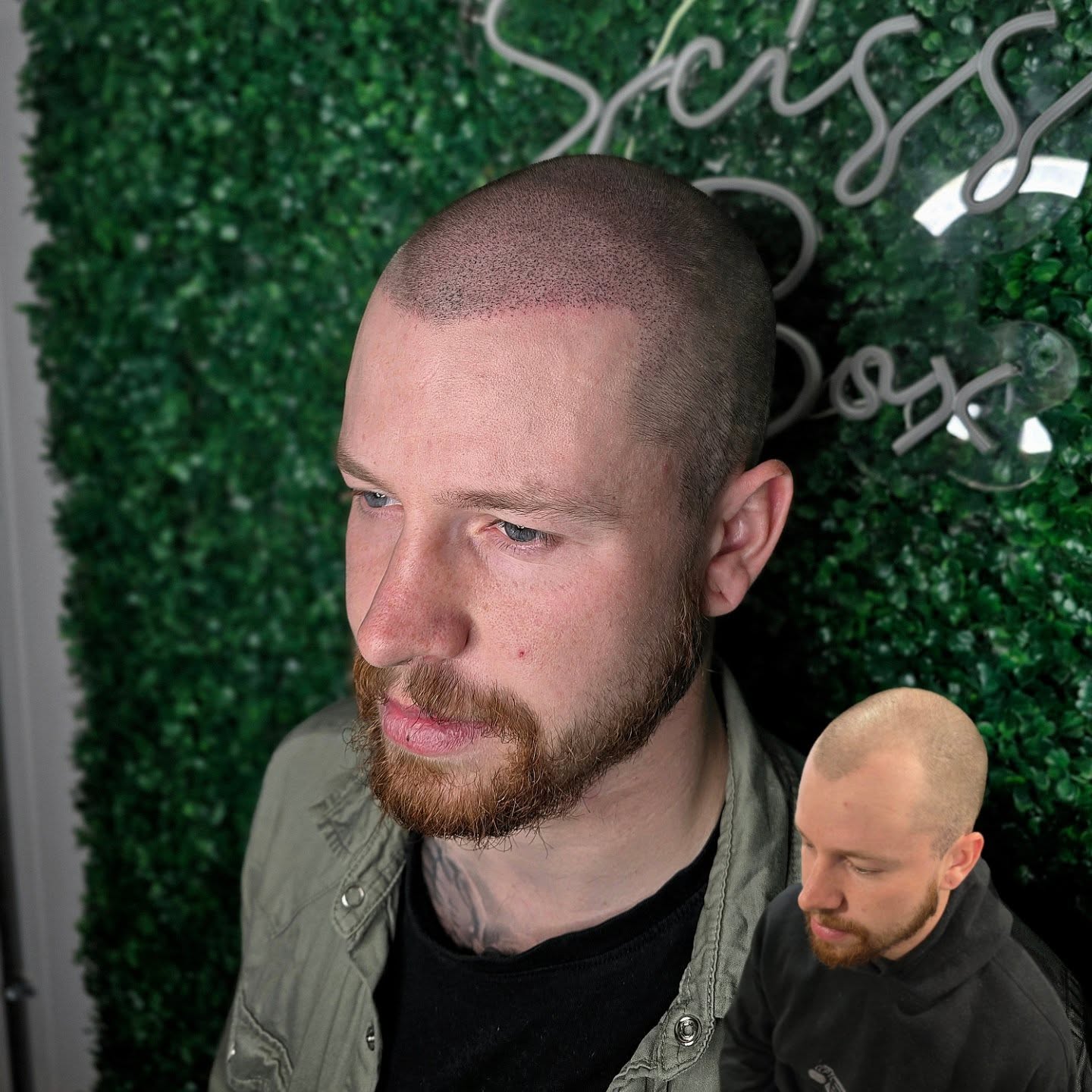 SMP TRANSFORMATION
Scalp Micro-Pigmentation results from 2 sessions!
Hairline restored!
Stop receding with SMP!
Natural results!
Hair tattooing to the highest standard!
📍Mildenhall/Bury St Edmunds
#smp #smptraining #hairtattoo #hairsystem #hairtransplant #hairloss #scalpmicropigmentation #trico #trichology #pigment #fakehair #wig #hairfibres #malepatternbaldness #receding #recedinghairline #skinhead #shavedhead #beard #buzzcut #barber #tattoo #hairgrowth